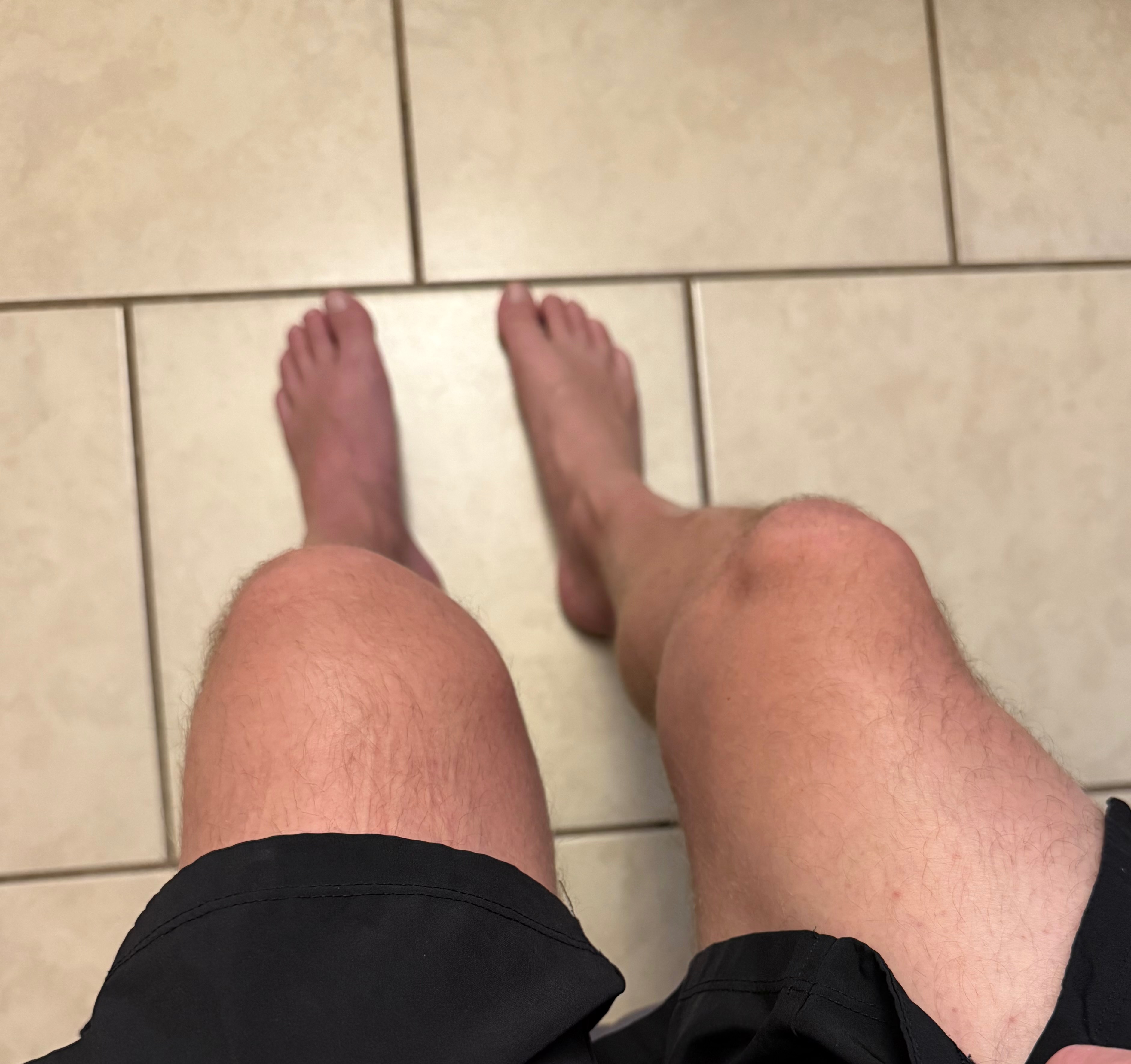 Support Tyler’s Knee Surgery Recovery campaign photo, 2 of 8