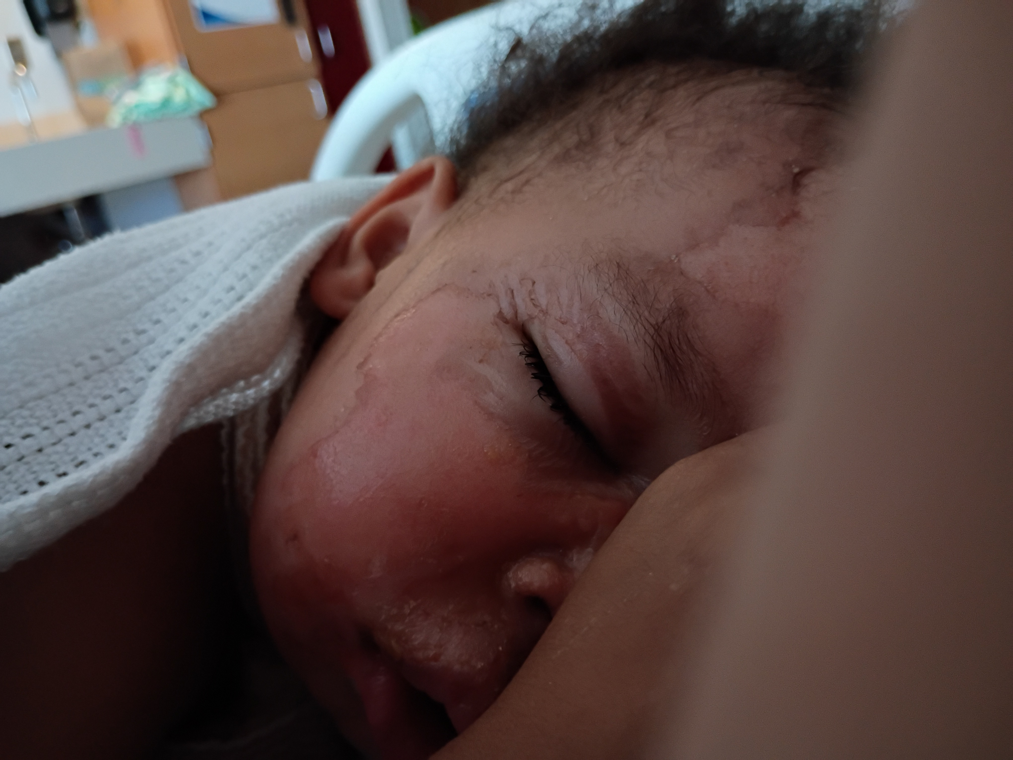 Support Malakai's Recovery Journey campaign photo, 5 of 8