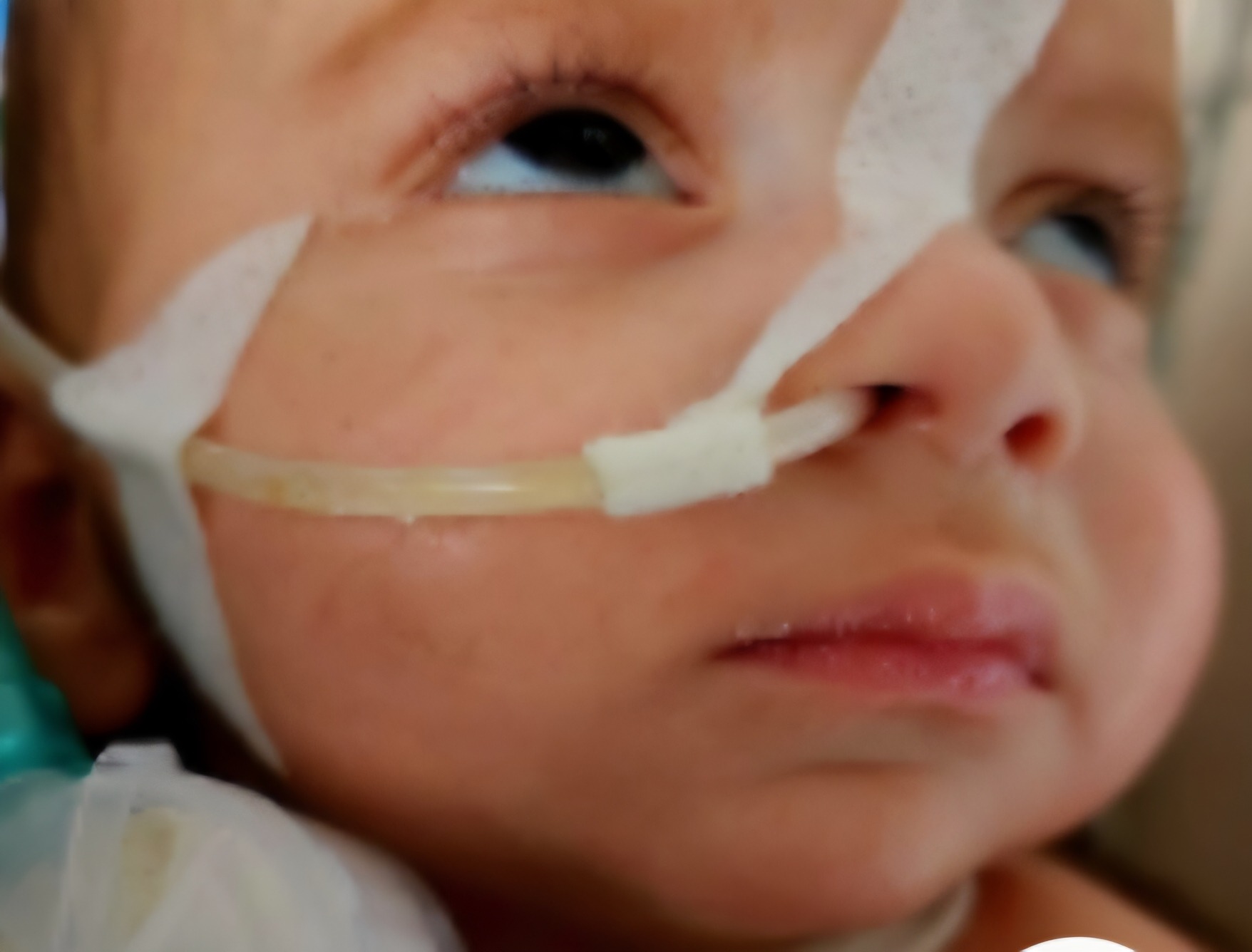 Help Save our little Guri's life. campaign photo, 2 of 5