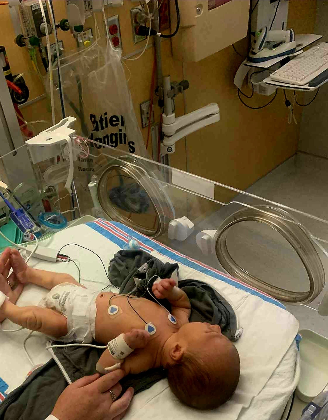 Help Save our little Guri's life. campaign photo, 4 of 5