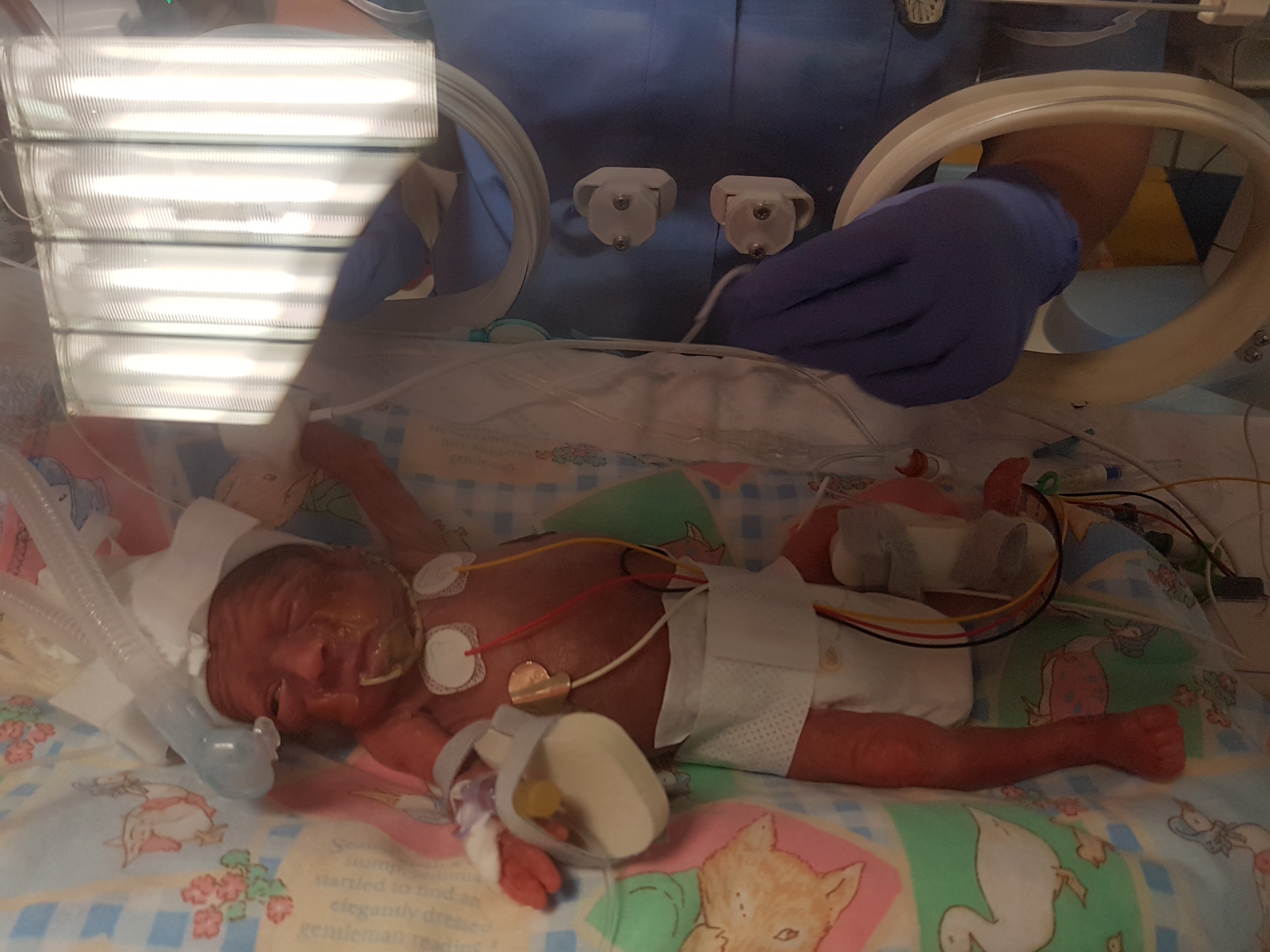 Help Gabriella Access Life-Changing Stem Cell Therapy campaign photo, 2 of 4