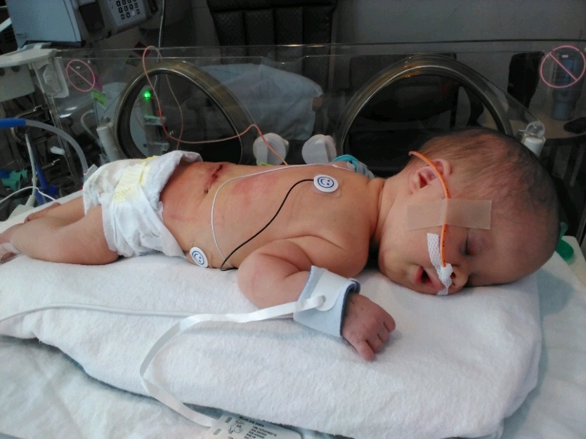 Morgan Cherish! Born Sept. 2025 , born with Spina bifida campaign photo, 2 of 4