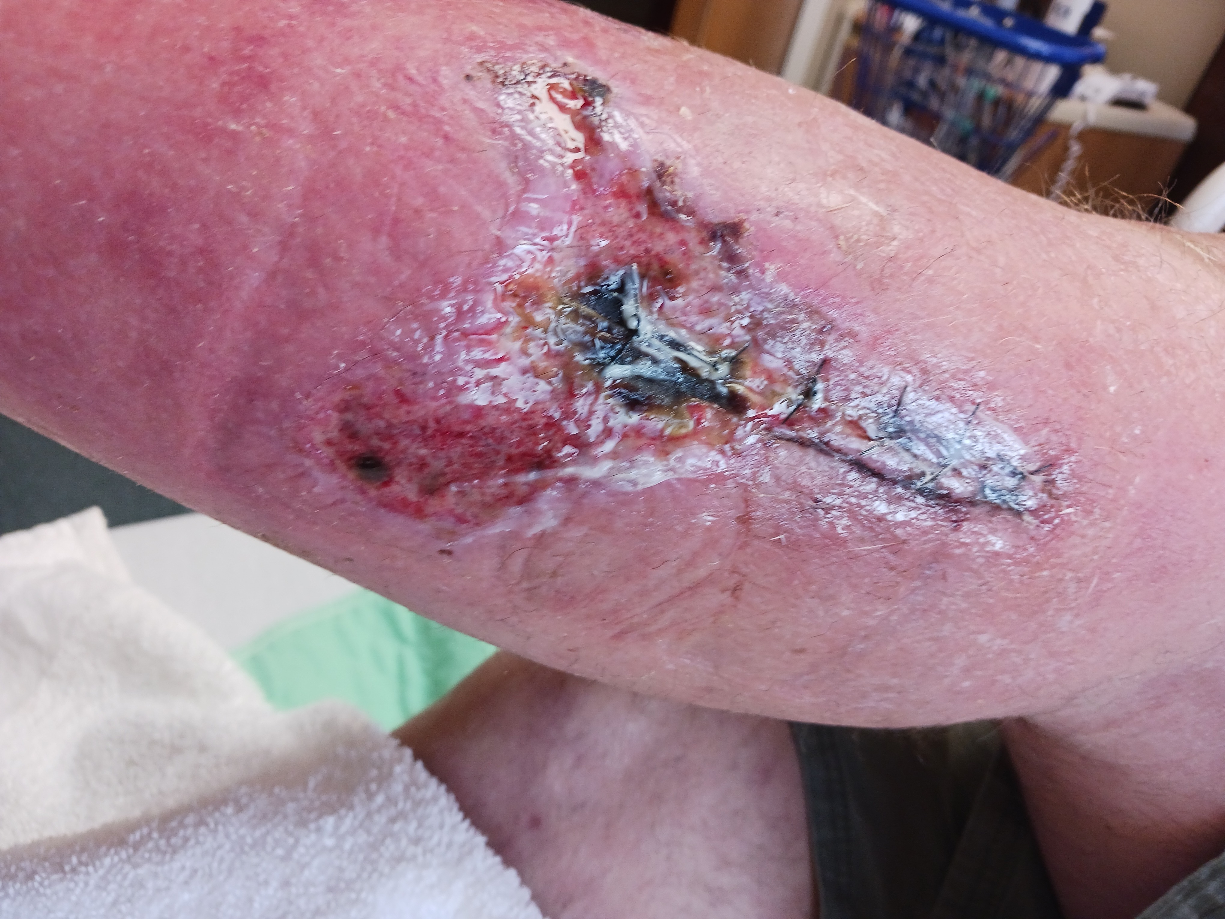 Help Cowboy Recover from Severe Infection campaign photo, 5 of 6