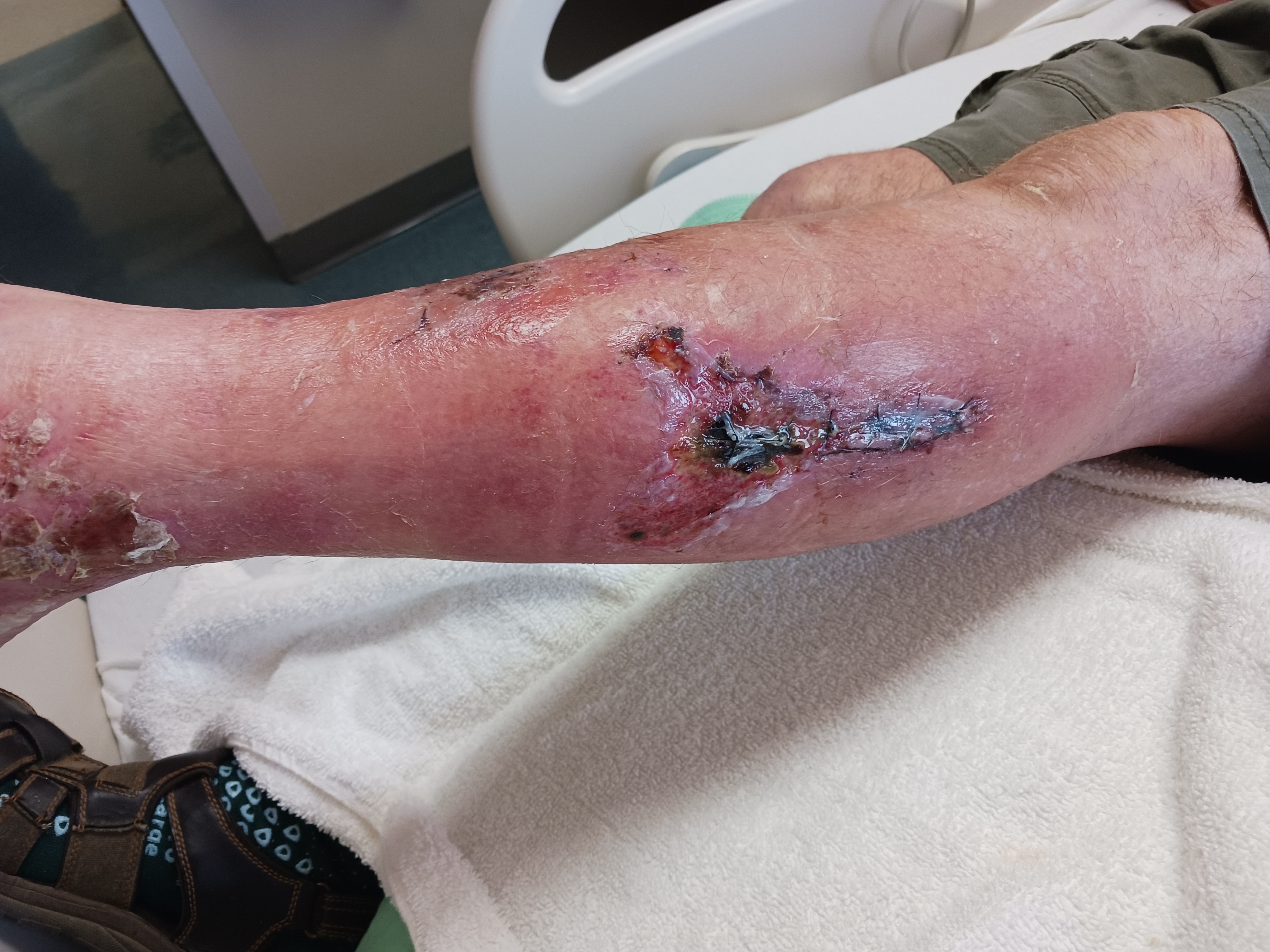 Help Cowboy Recover from Severe Infection campaign photo, 2 of 6
