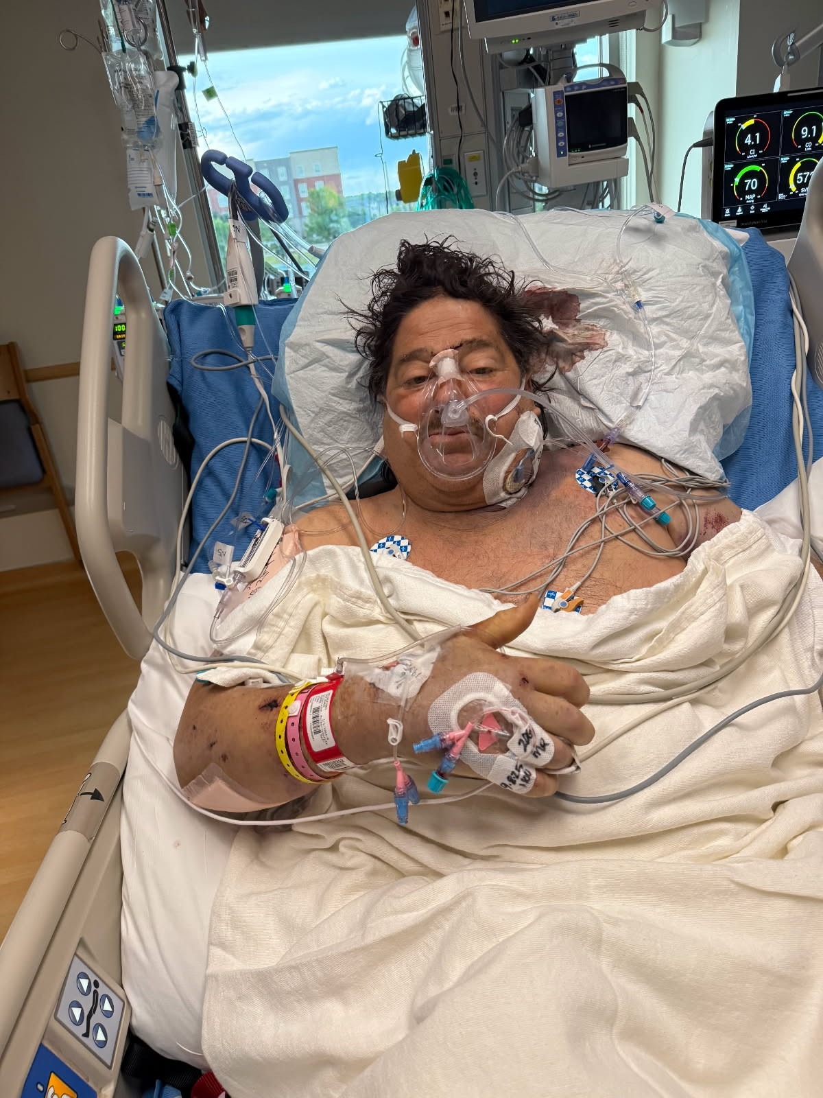 Help Needed for Frank Ricci After Devastating Crash campaign photo, 4 of 7