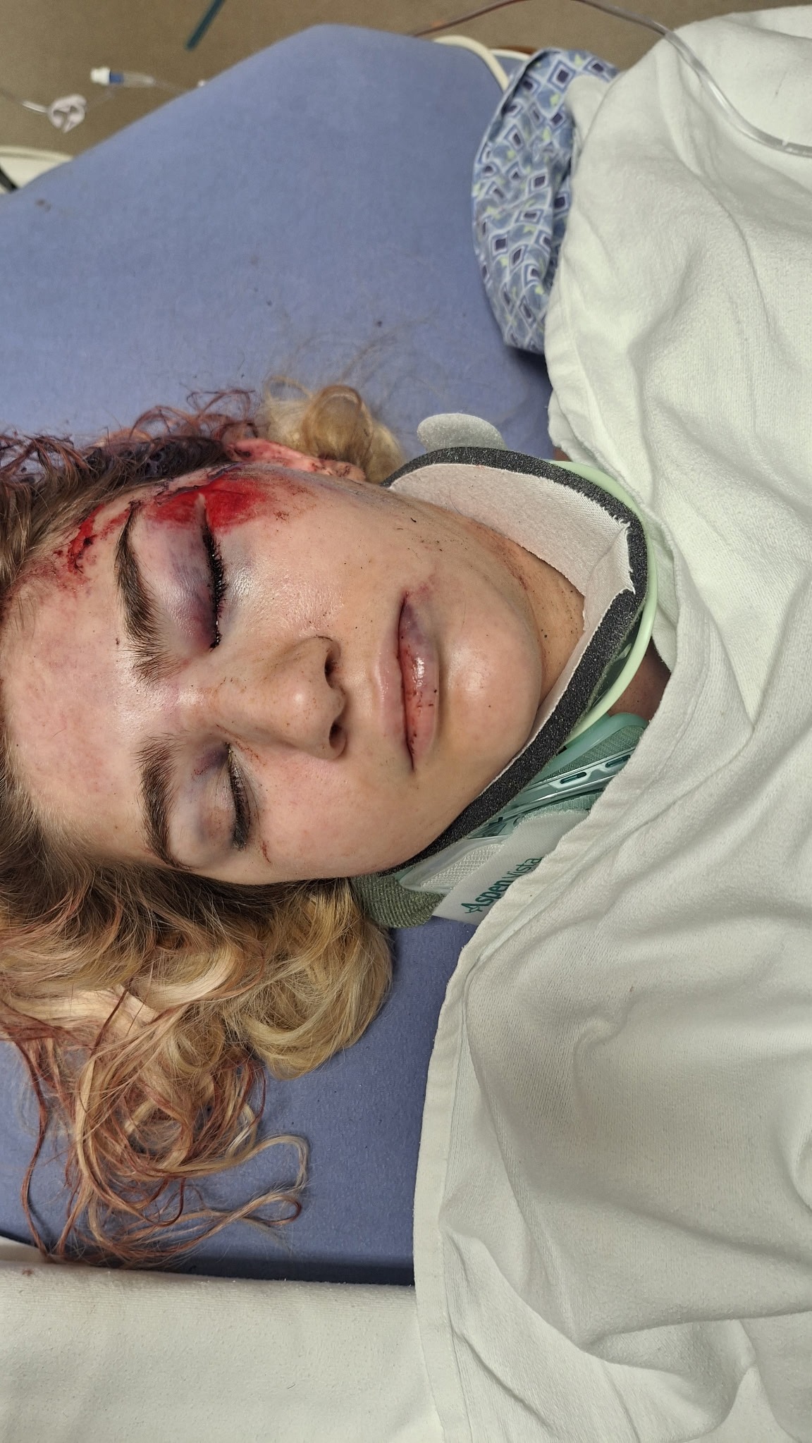 Aid Scott's Daughter in Her Road to Recovery campaign photo, 2 of 7