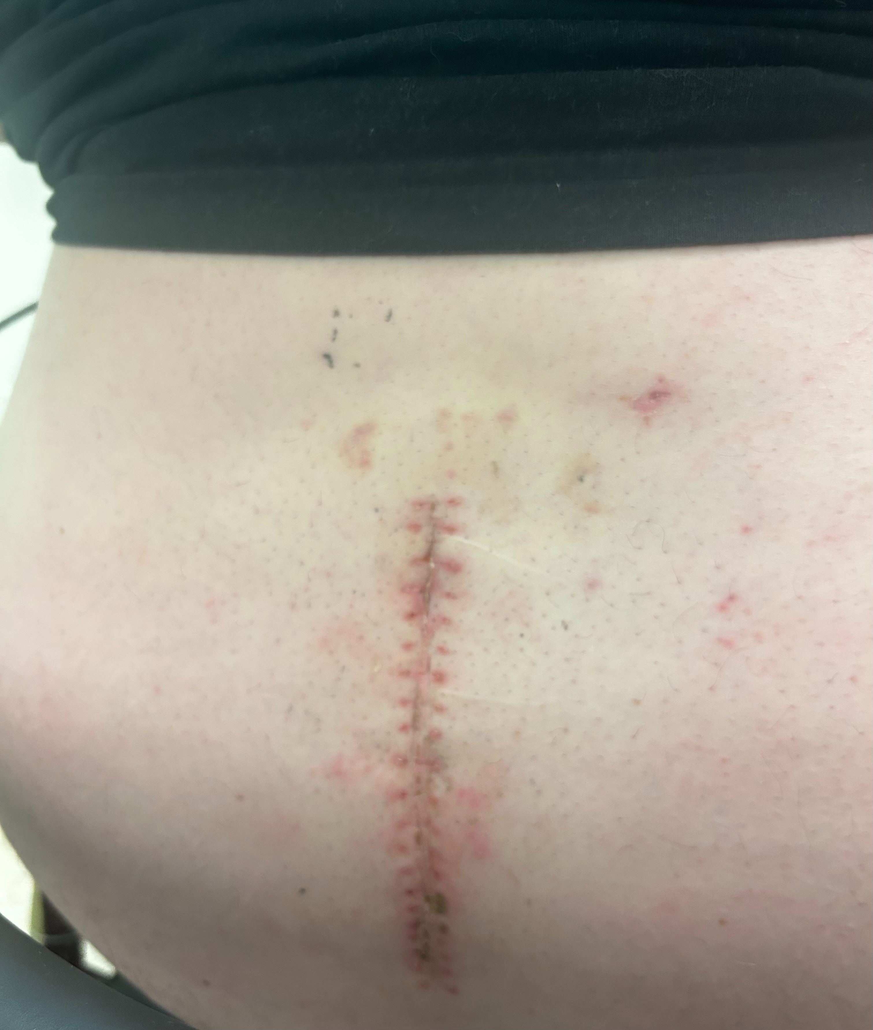 Supporting Our Family Post Back Surgeries campaign photo, 6 of 7