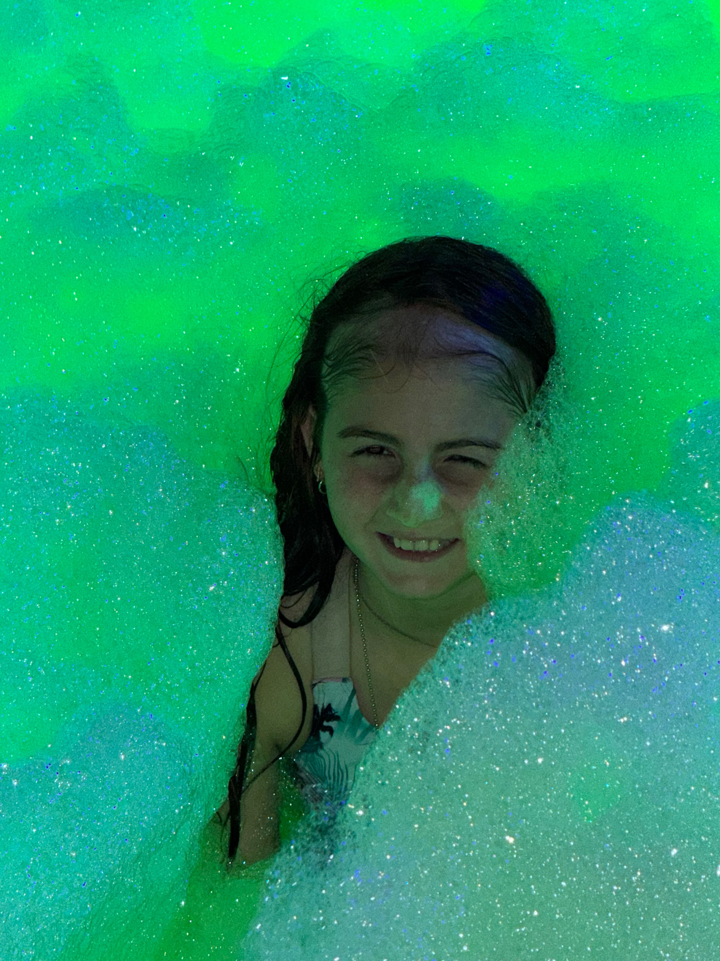 Help Lyndzey Get the Treatment She Needs 4 Trichotillomania campaign photo, 5 of 7