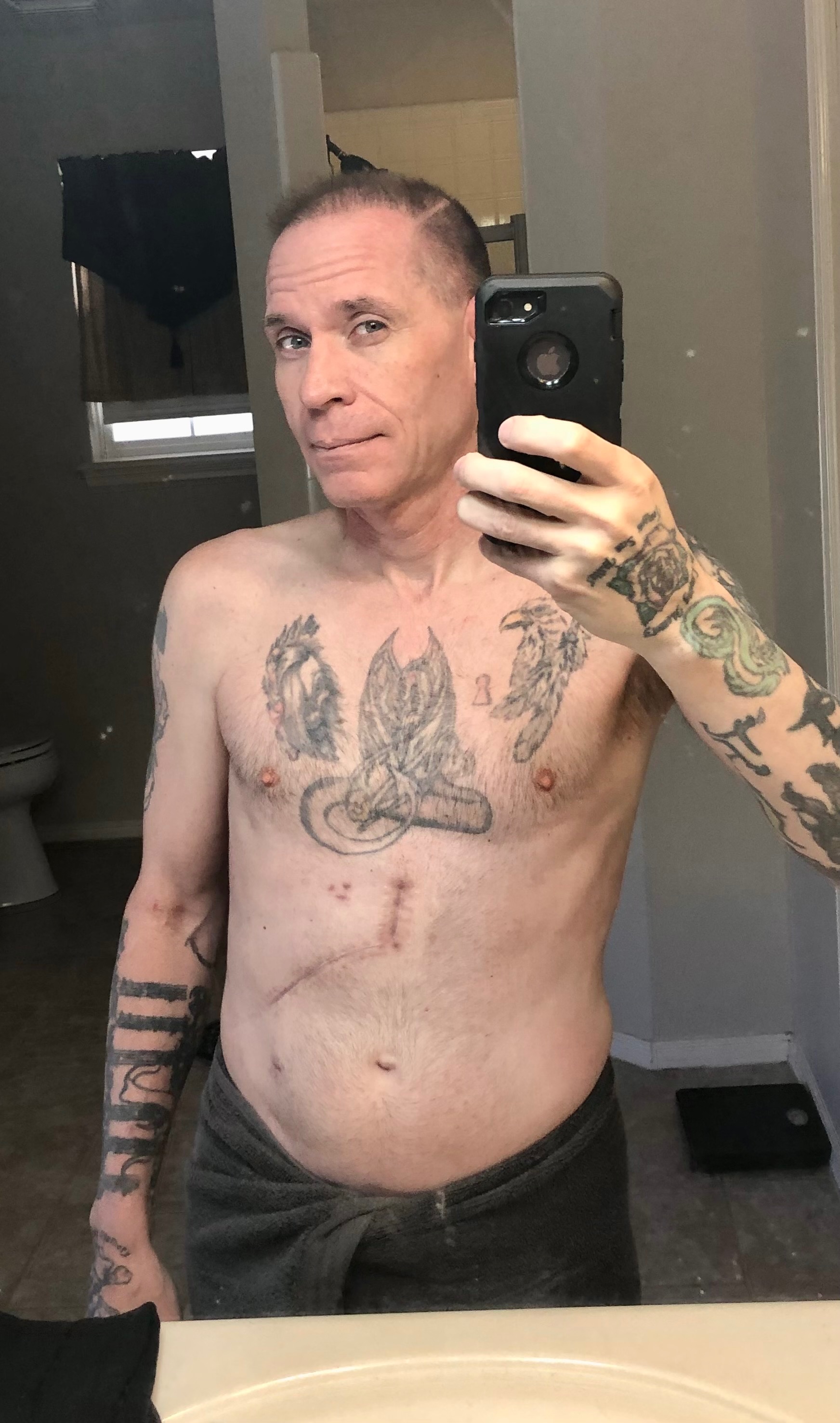 Help Bill Afford Life-Saving Treatment campaign photo, 5 of 6