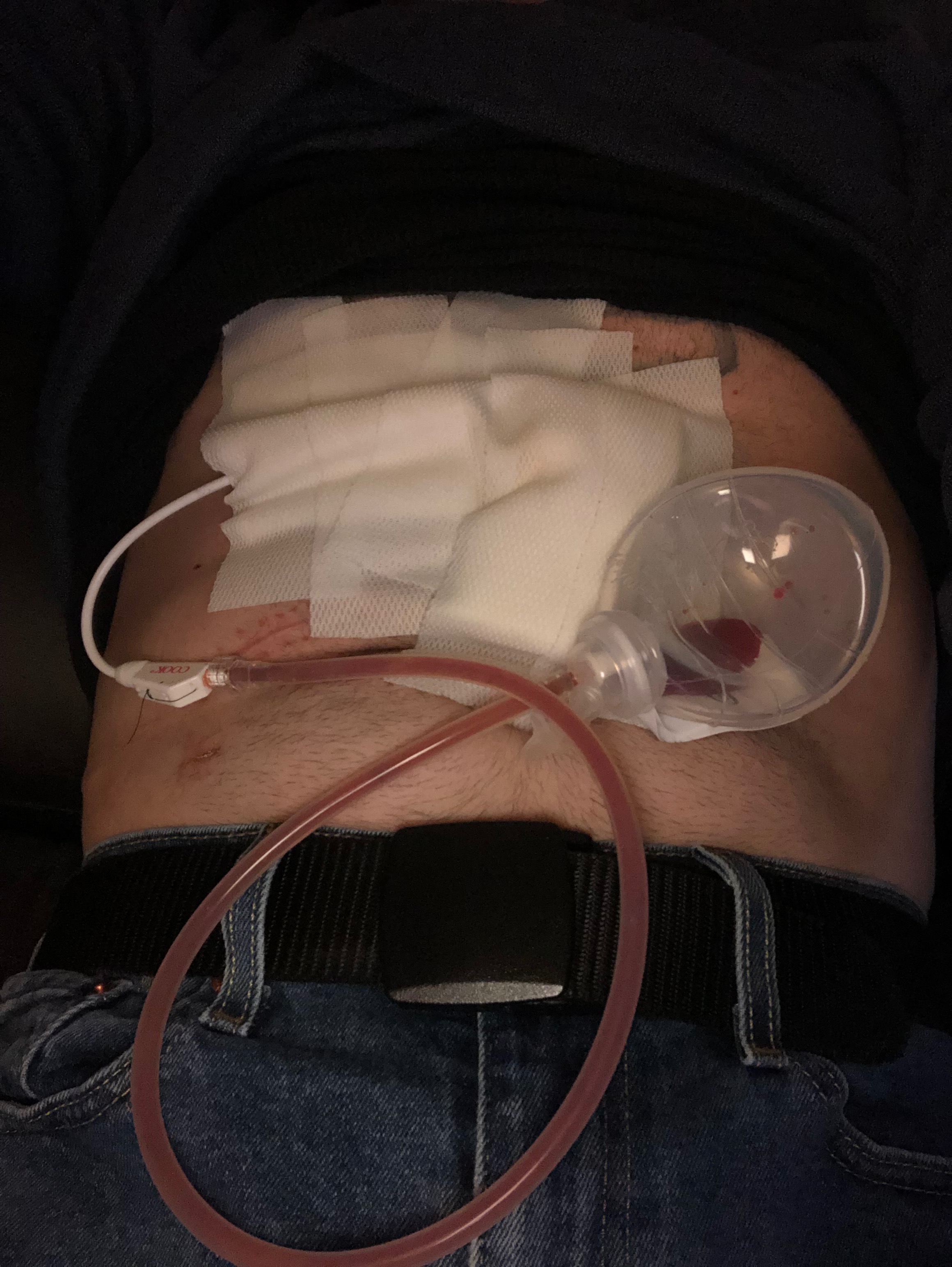 Help Bill Afford Life-Saving Treatment campaign photo, 4 of 6