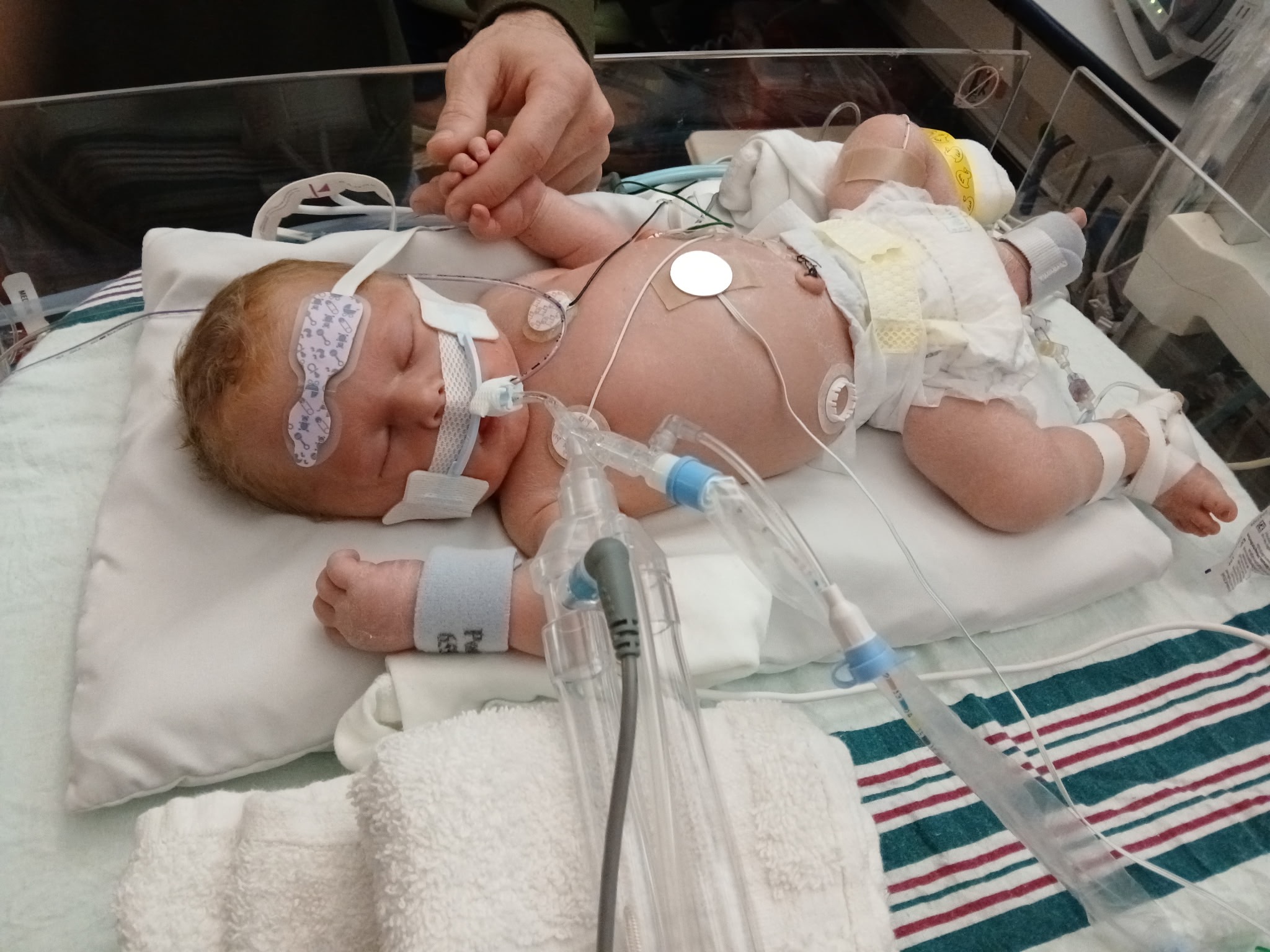 Macon’s NICU Recovery campaign photo, 2 of 5