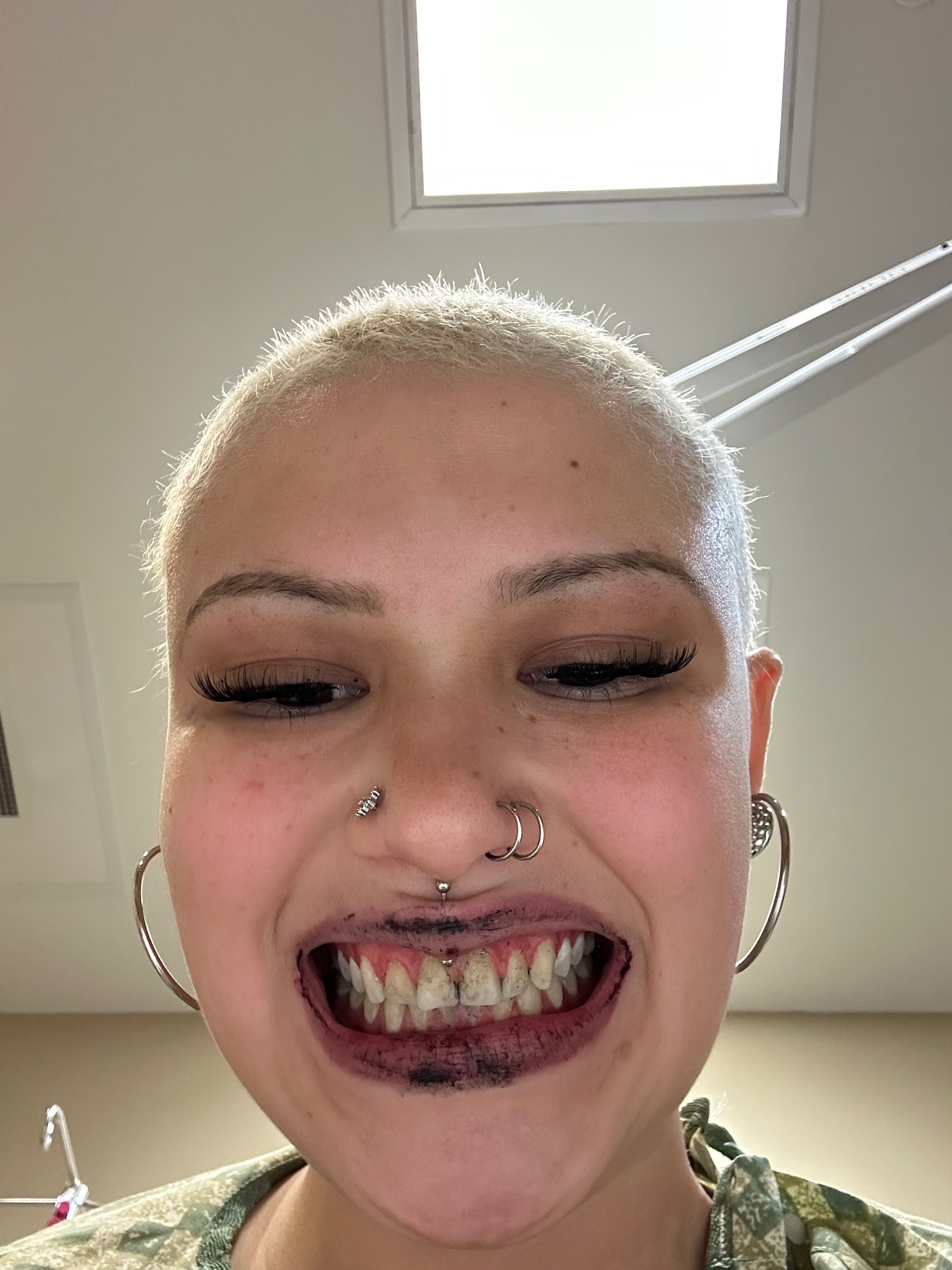 Help Ariana Get Life-Changing OCD Treatment campaign photo, 2 of 8