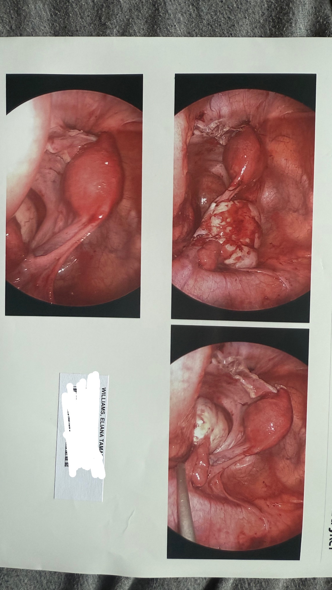 IVF journey campaign photo, 5 of 6