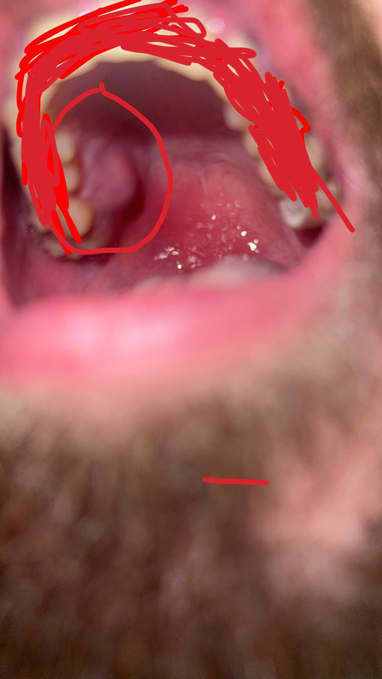 Urgent Help Needed for Life-Threatening Dental Infection campaign photo, 2 of 4