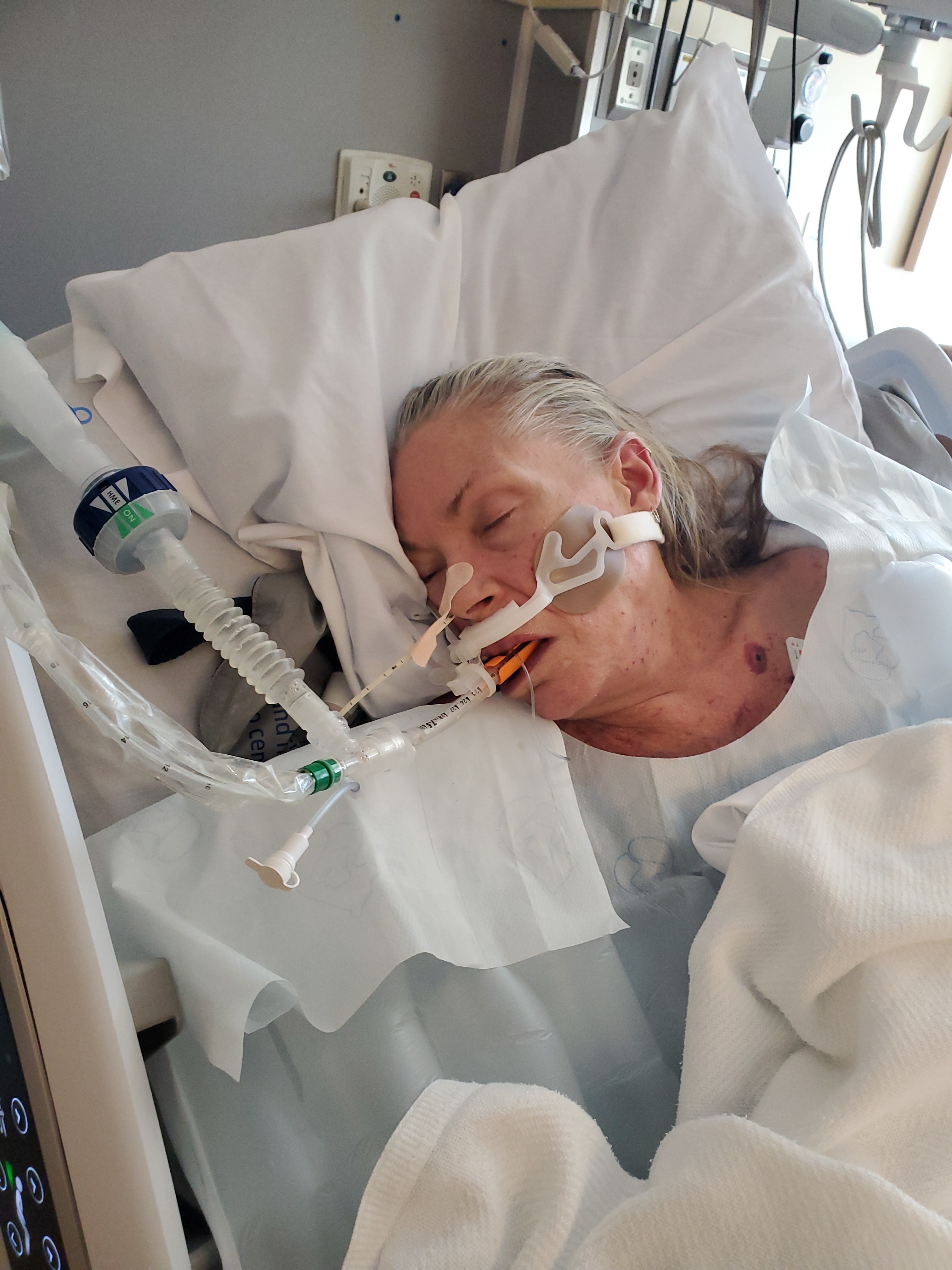 Support Stacey's Critical Healing Journey campaign photo, 2 of 4