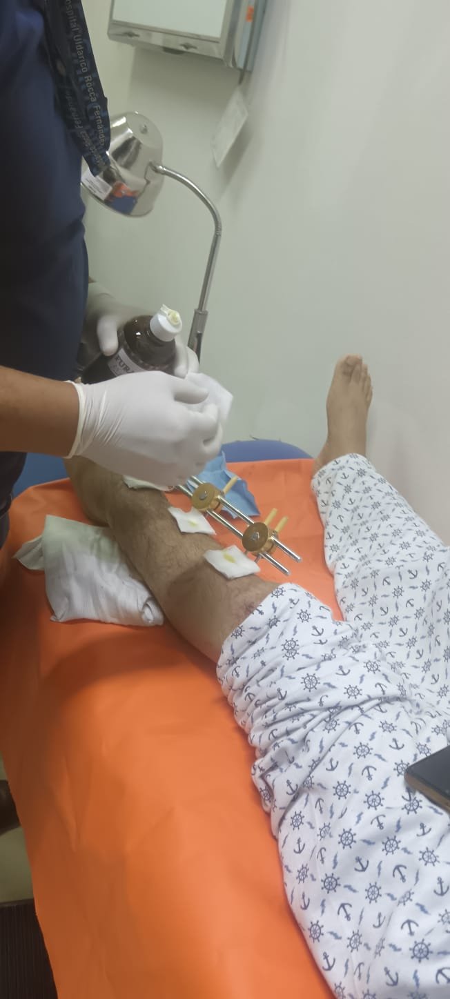 Save Victor's Leg: Urgent Medical Help Needed campaign photo, 5 of 8