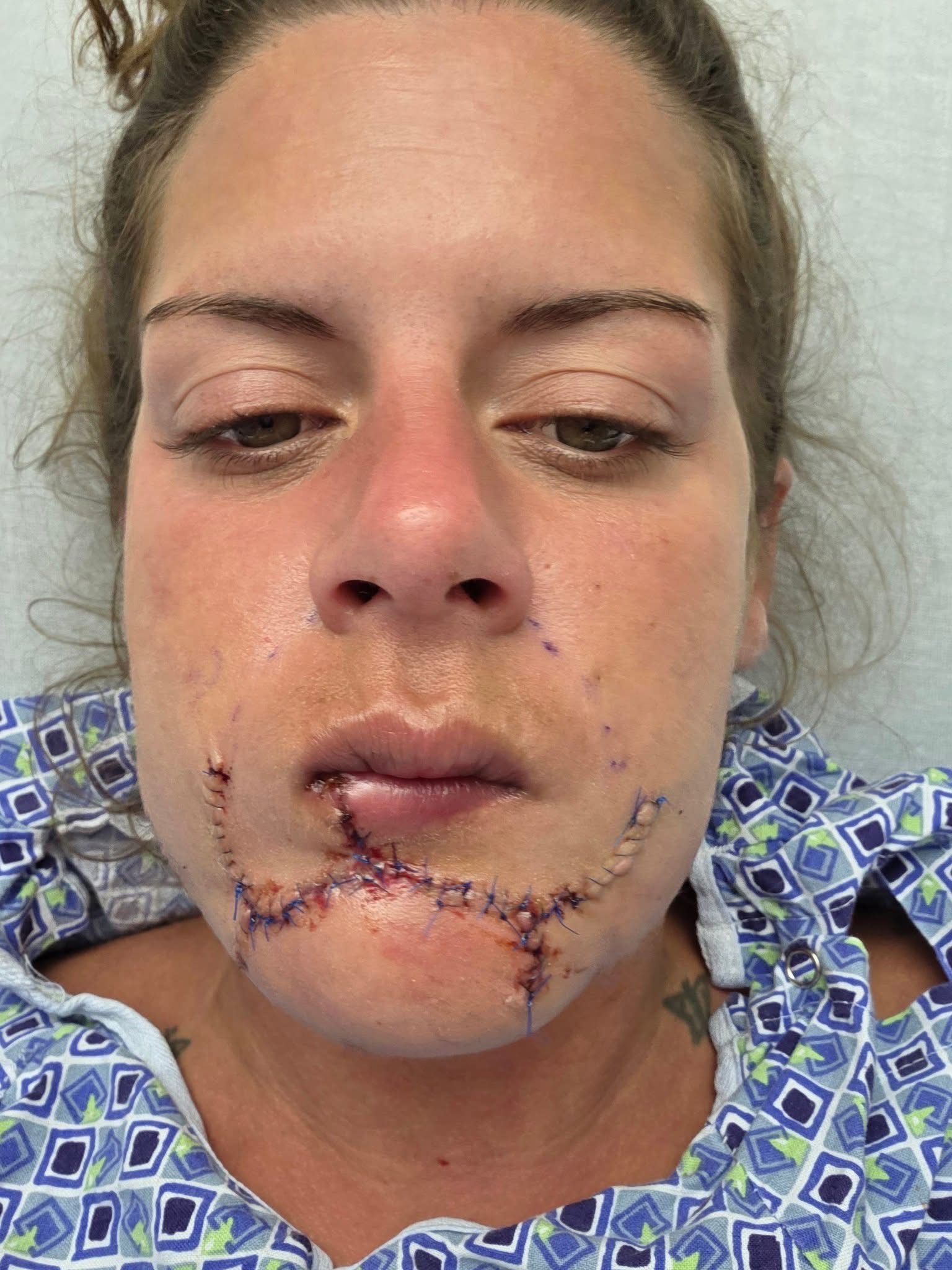 Help Minna Heal From A Tragic Dog Attack... campaign photo, 4 of 6