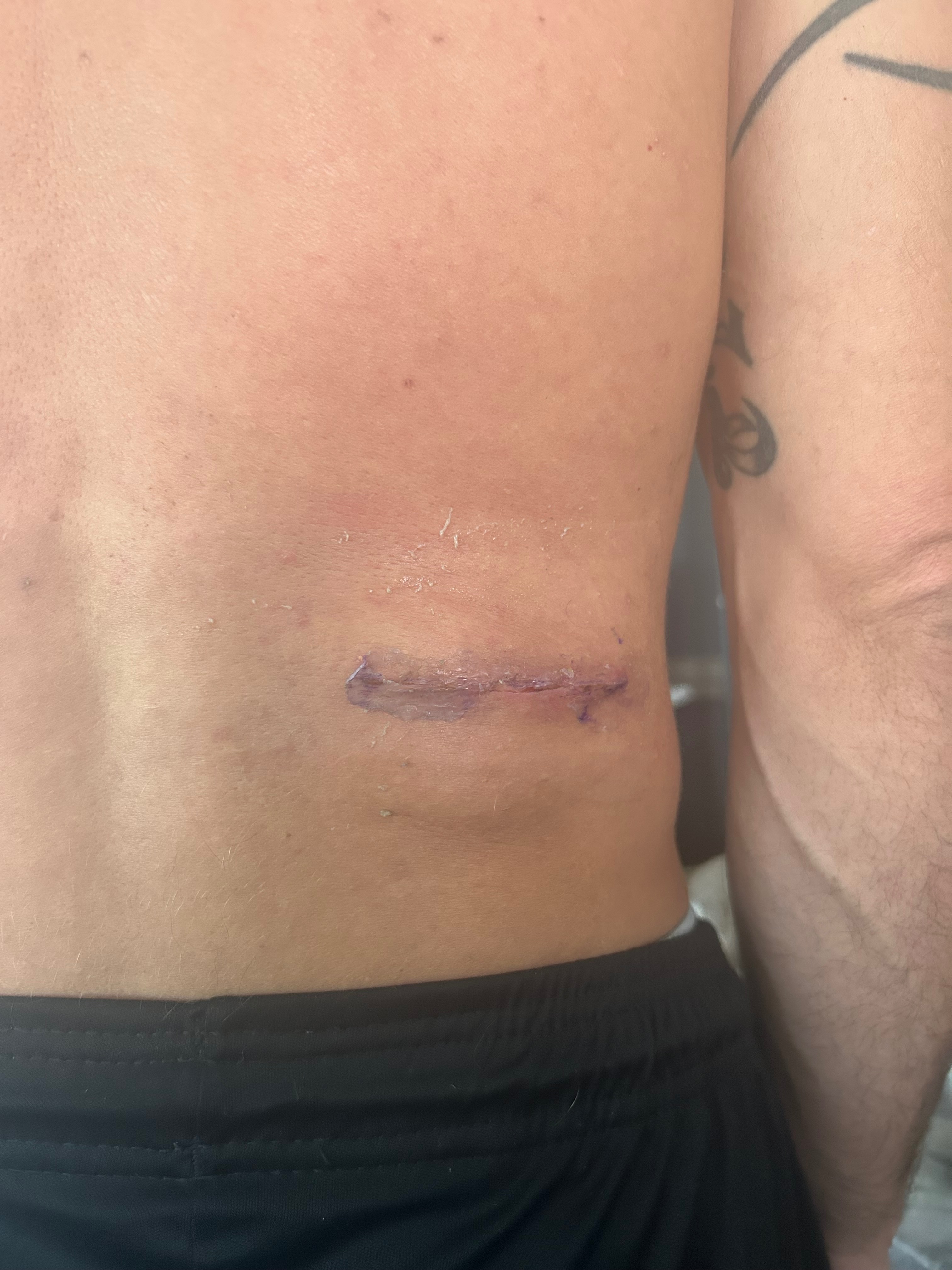Help Rebuild After Life-Changing Injuries campaign photo, 6 of 7