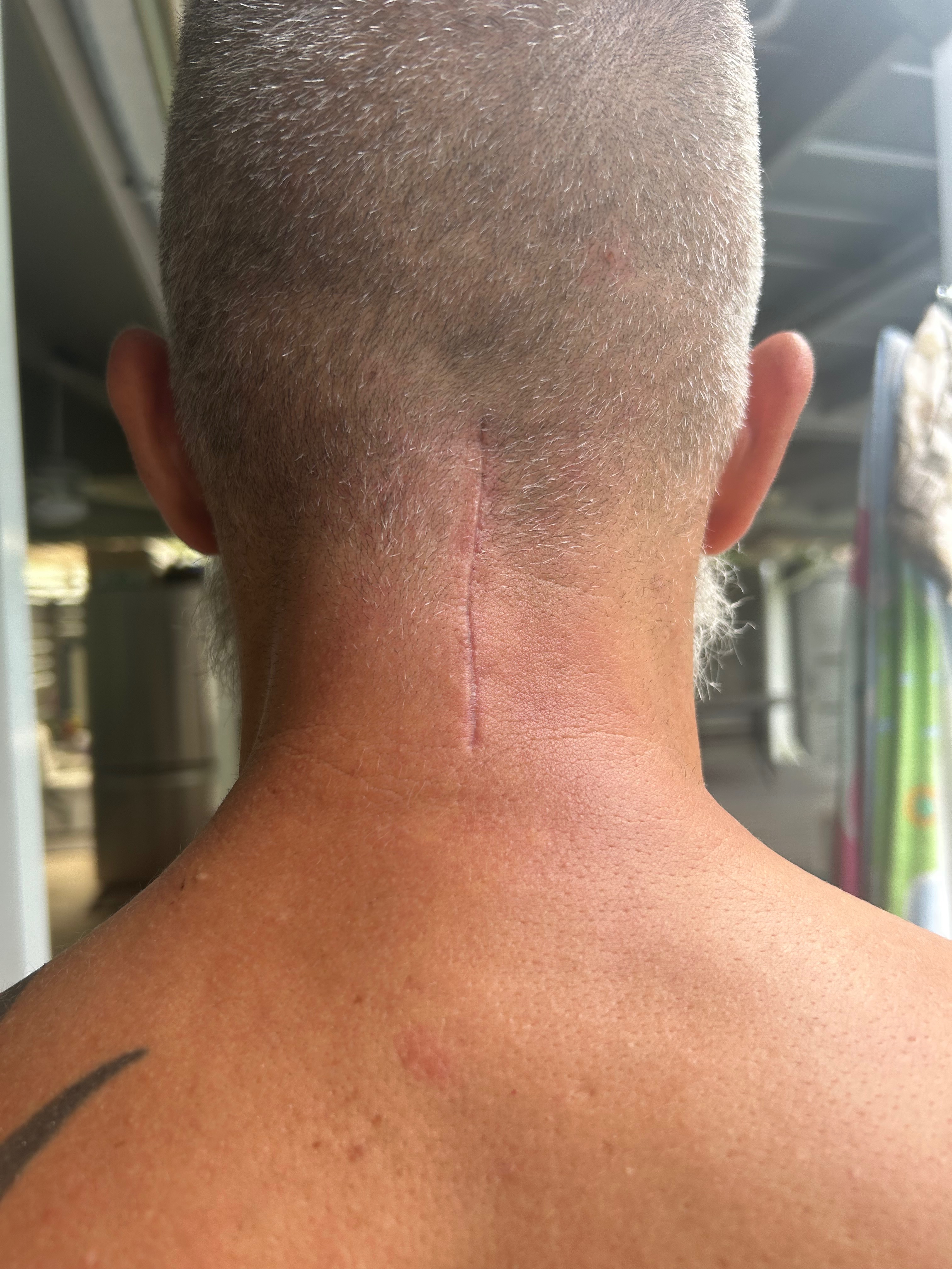 Help Rebuild After Life-Changing Injuries campaign photo, 2 of 7