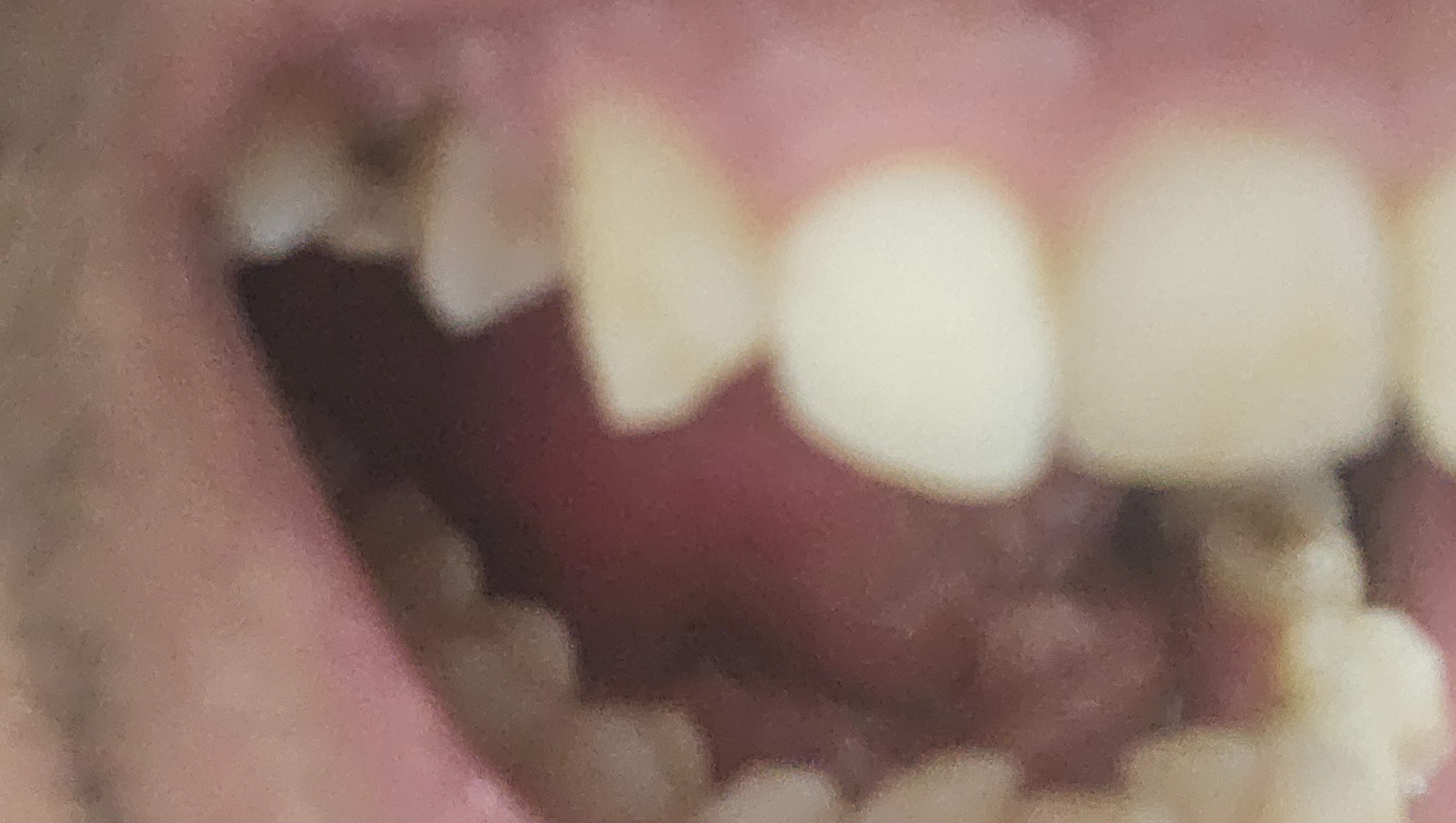 Fundraiser image