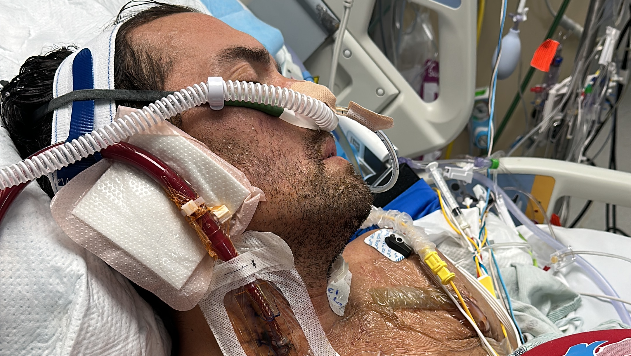 Donate to Michael's Heart Transplant Journey photo