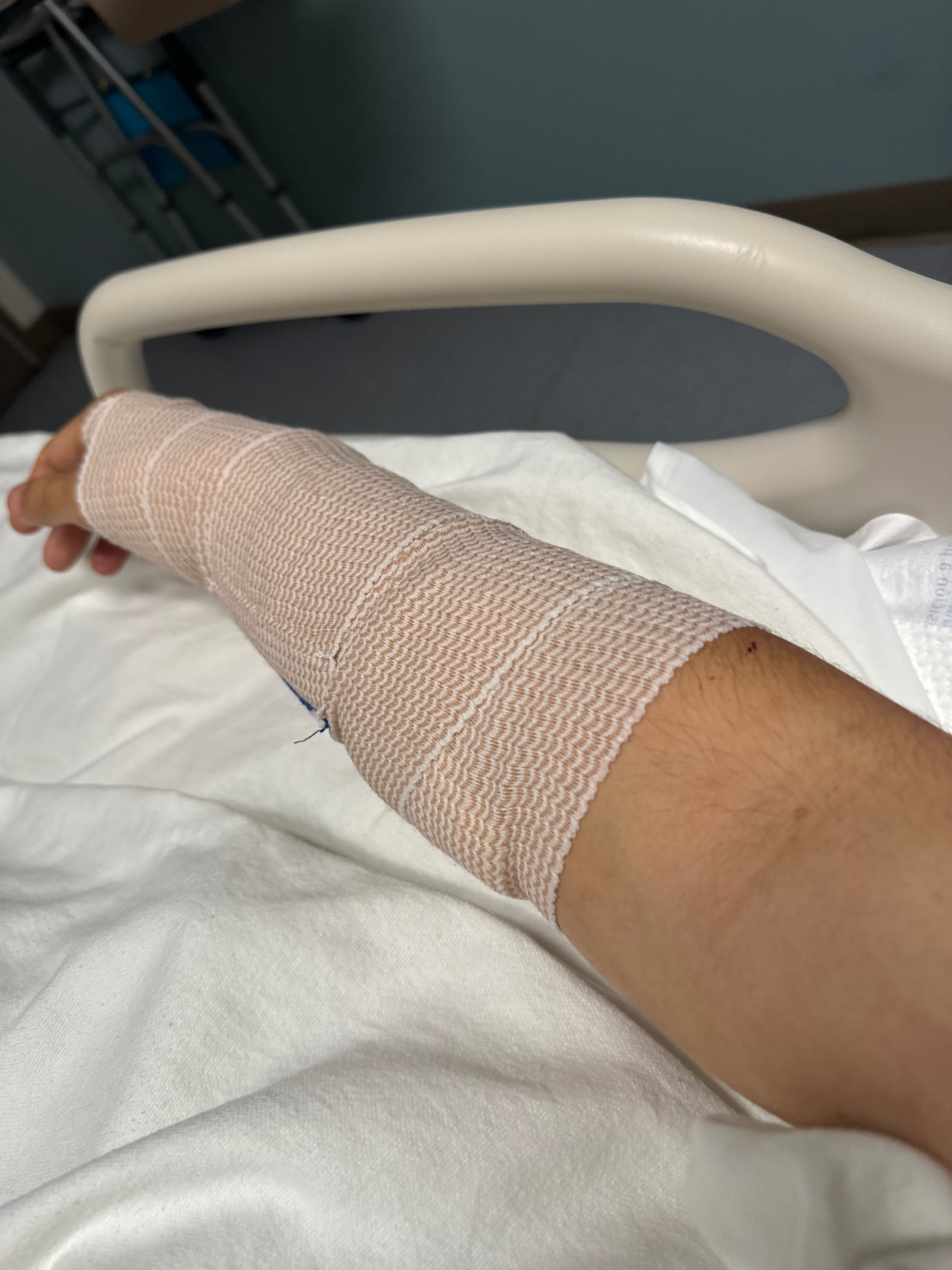 Hand Surgery Recovery campaign photo, 5 of 8