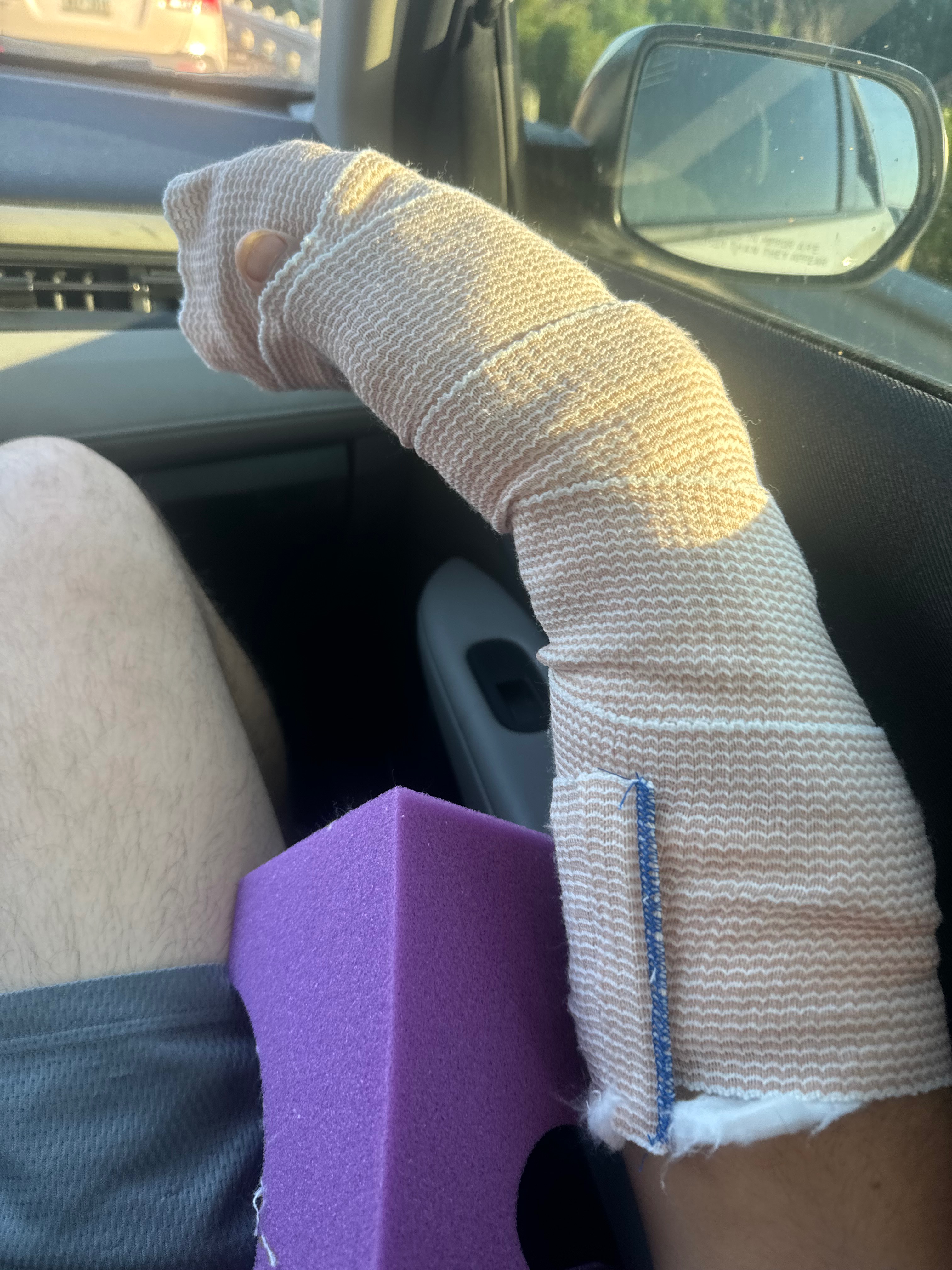Hand Surgery Recovery campaign photo, 4 of 8