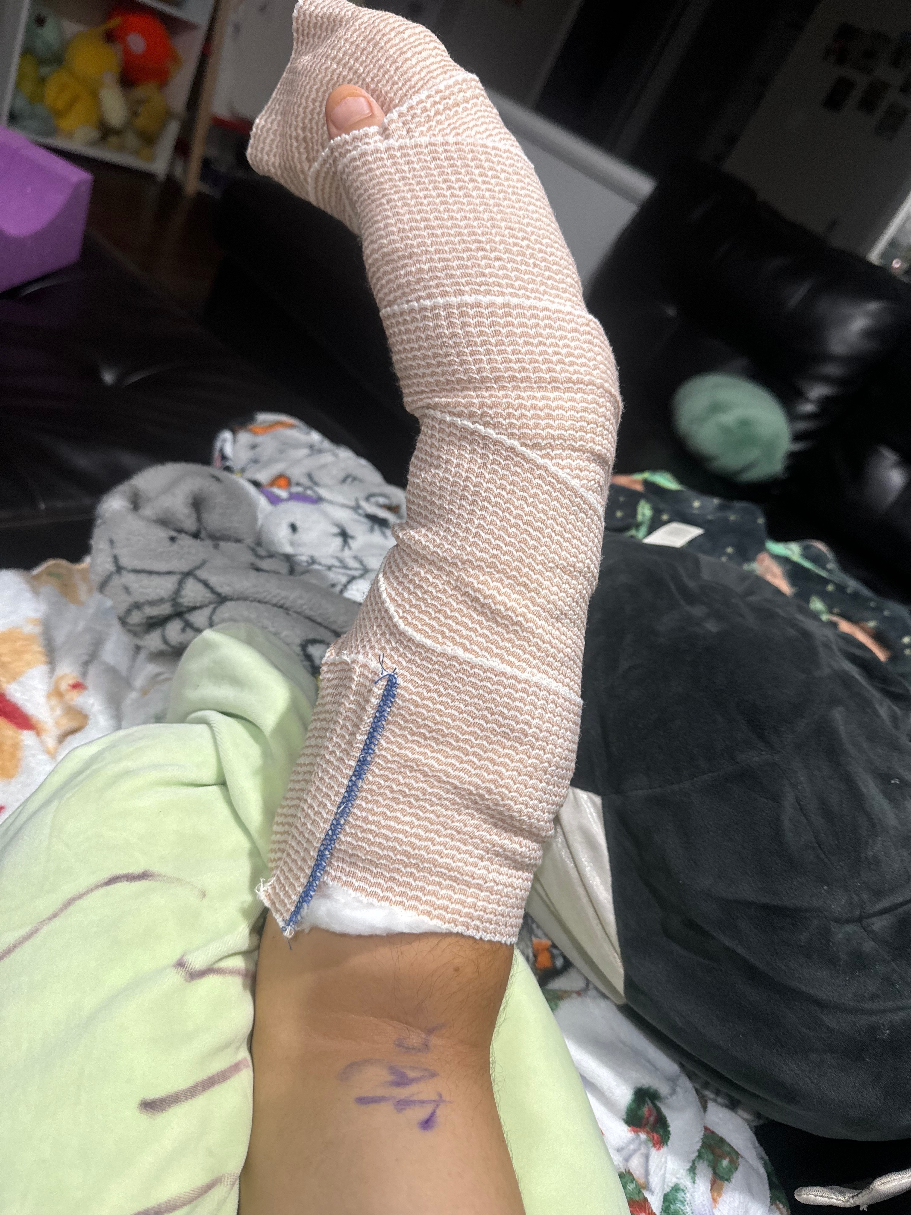 Hand Surgery Recovery campaign photo, 6 of 8
