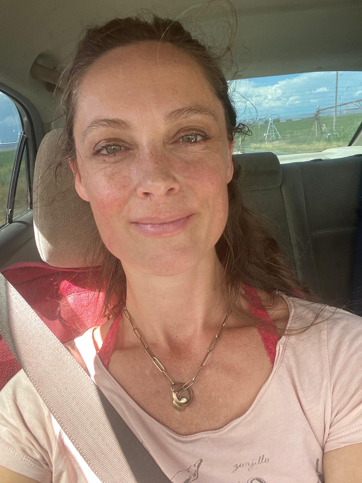 Help Needed for Urgent Surgery and Recovery campaign photo, 2 of 5