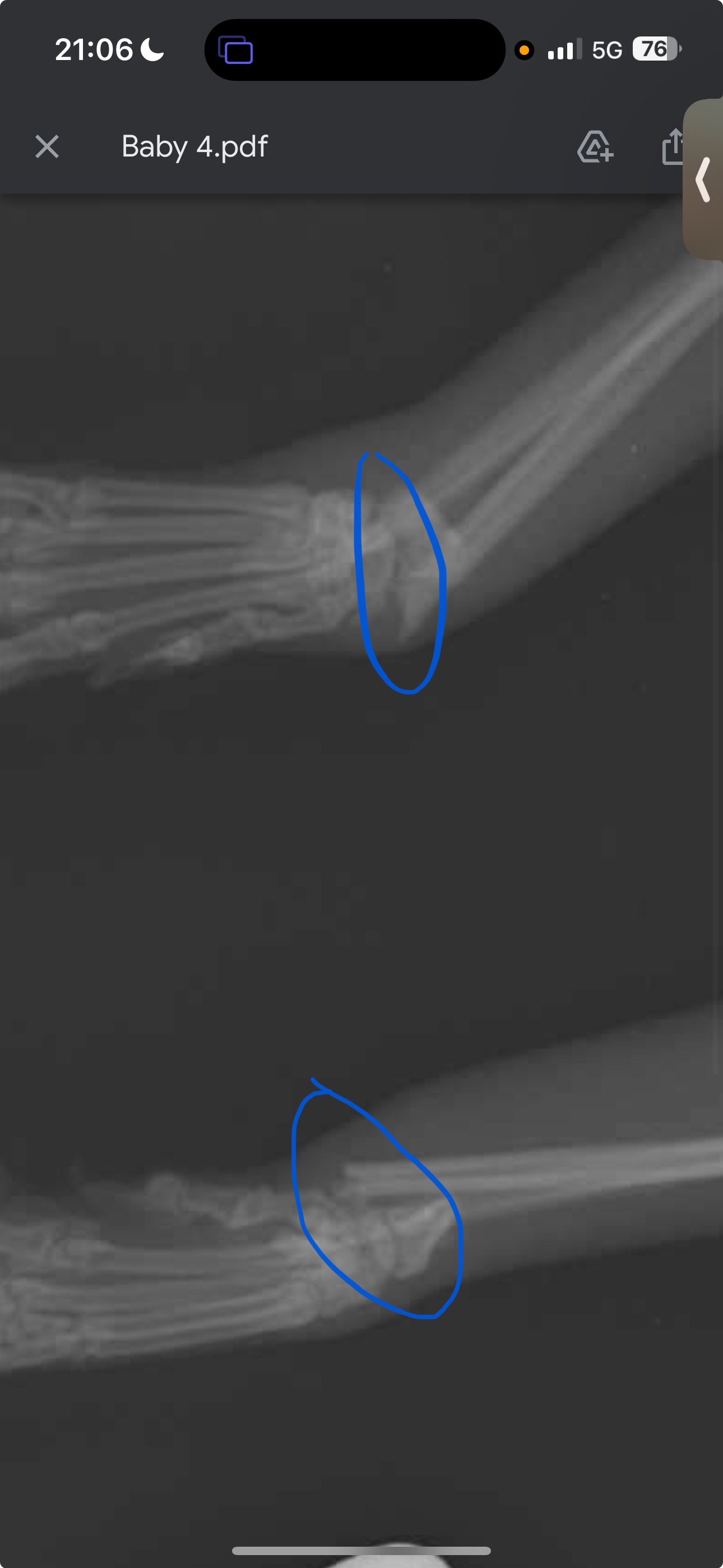 Help Bebi to walk and eat again after a 4-story fall campaign photo, 5 of 8