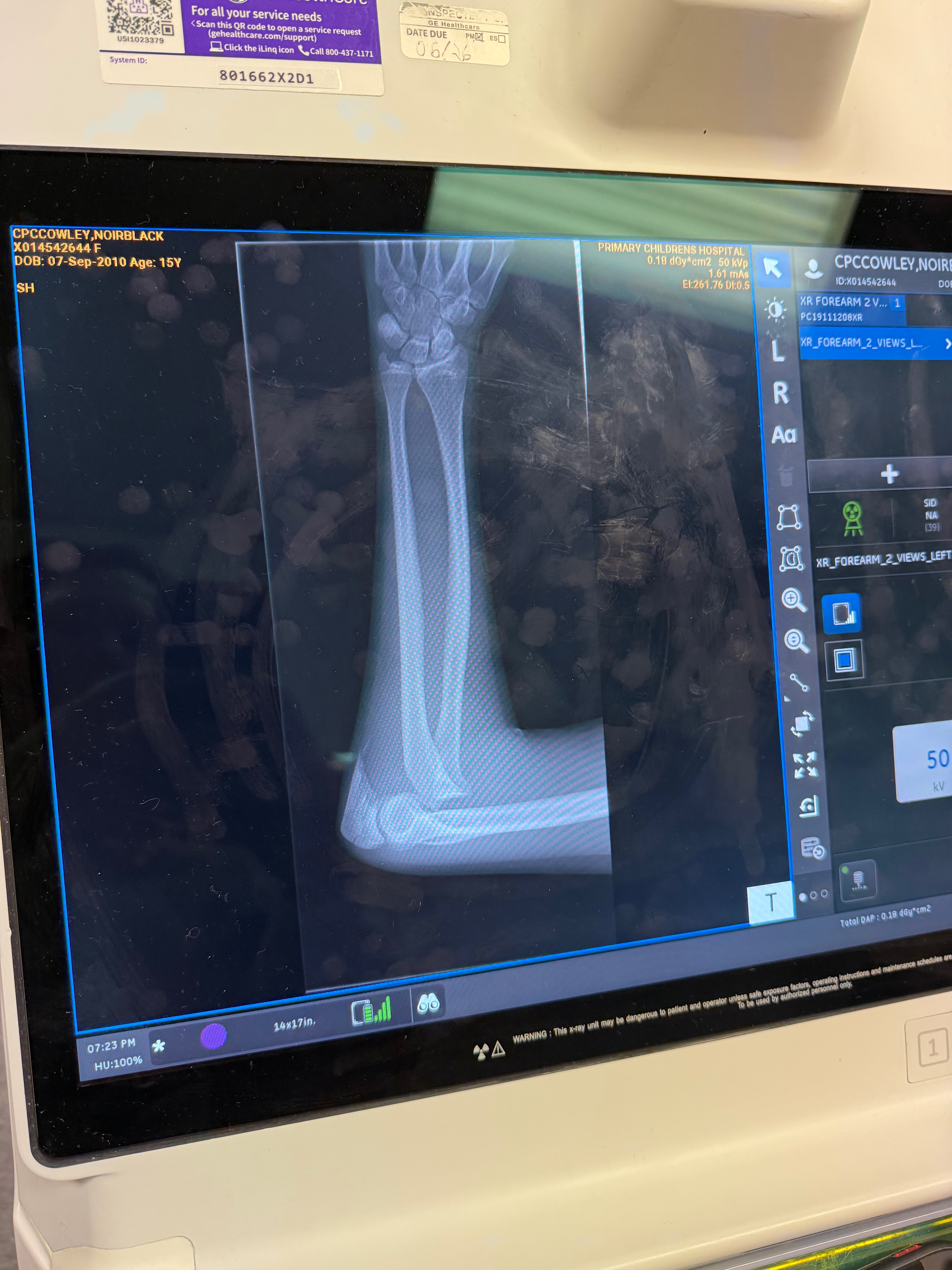 Donate to help Eloise Vermouth heal from ATV accident campaign photo, 5 of 6