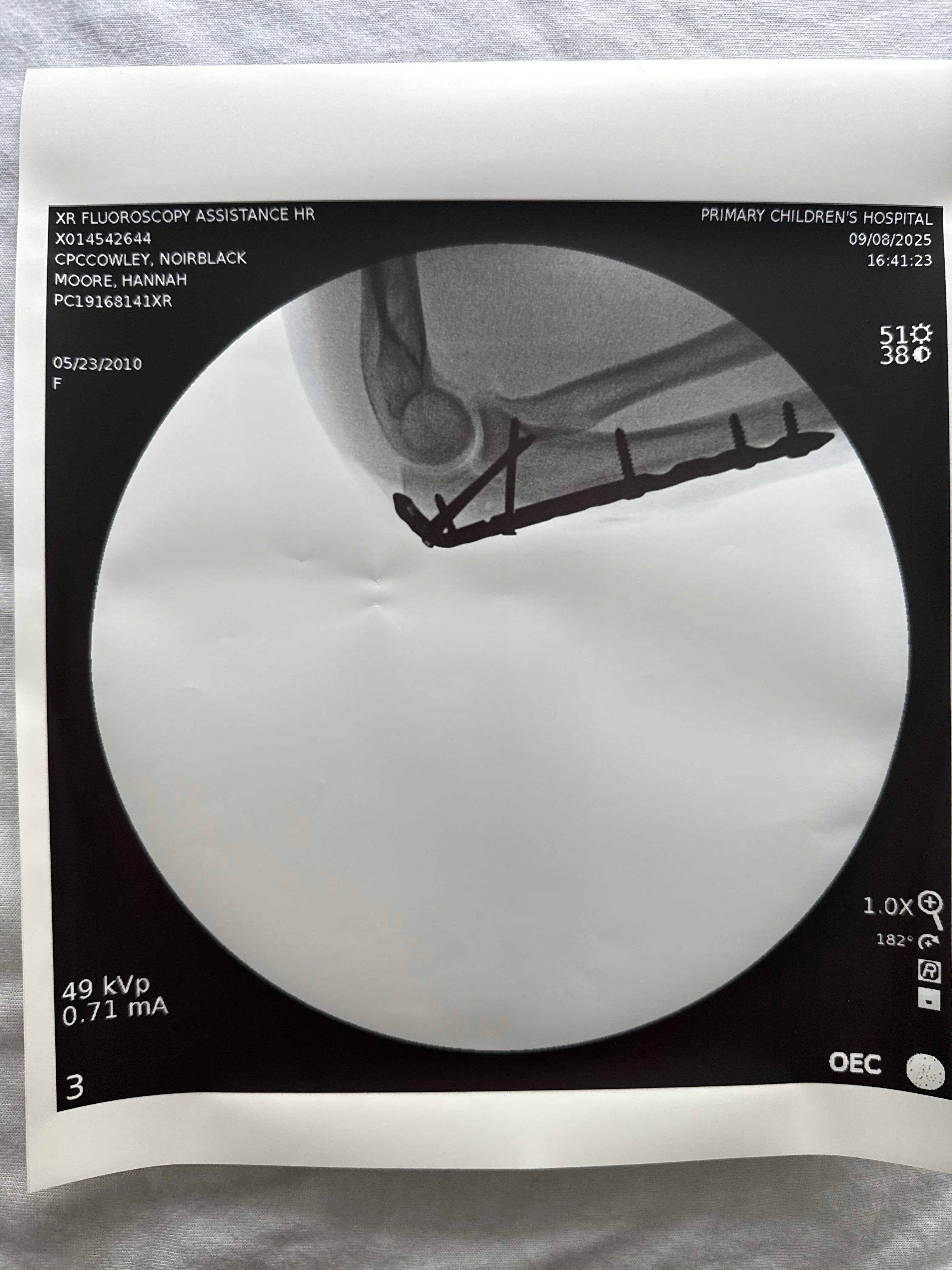 Donate to help Eloise Vermouth heal from ATV accident campaign photo, 2 of 6