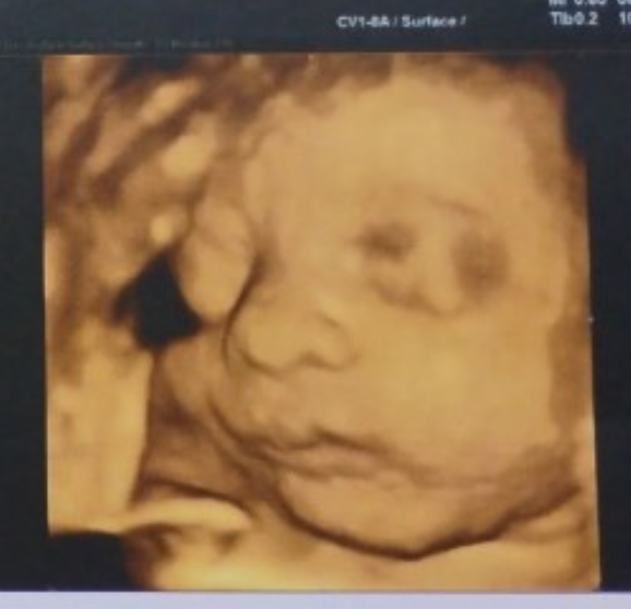 Please donate so my son will finally become a dad. campaign photo, 4 of 6