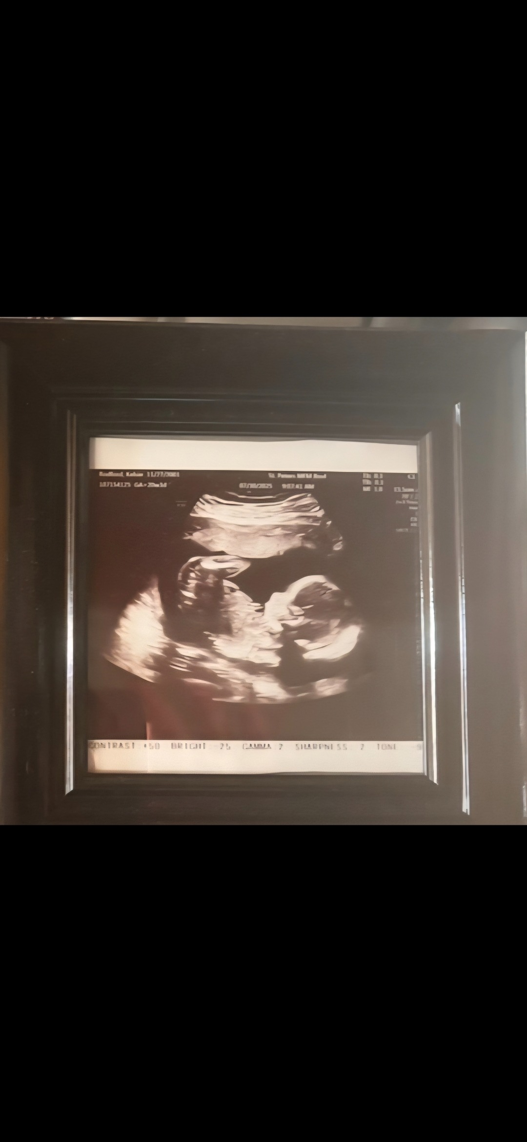 Prayers and Donations for Baby Dragon's Health campaign photo, 4 of 5