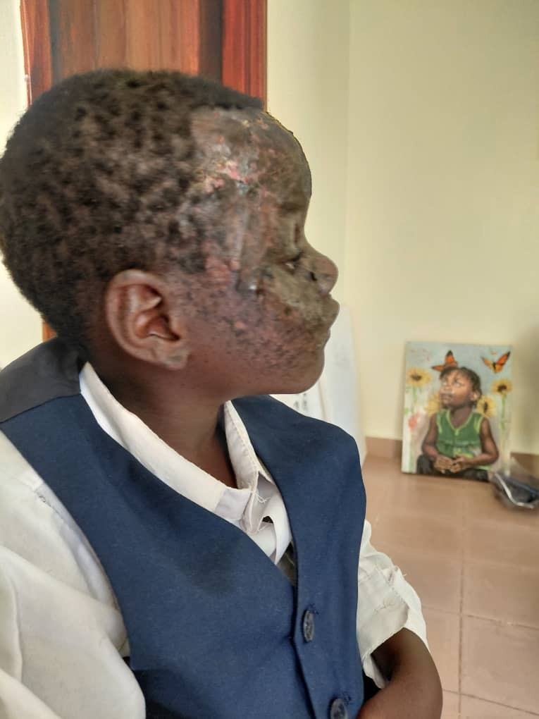 No child should be left to fight a disease on their own campaign photo, 4 of 6