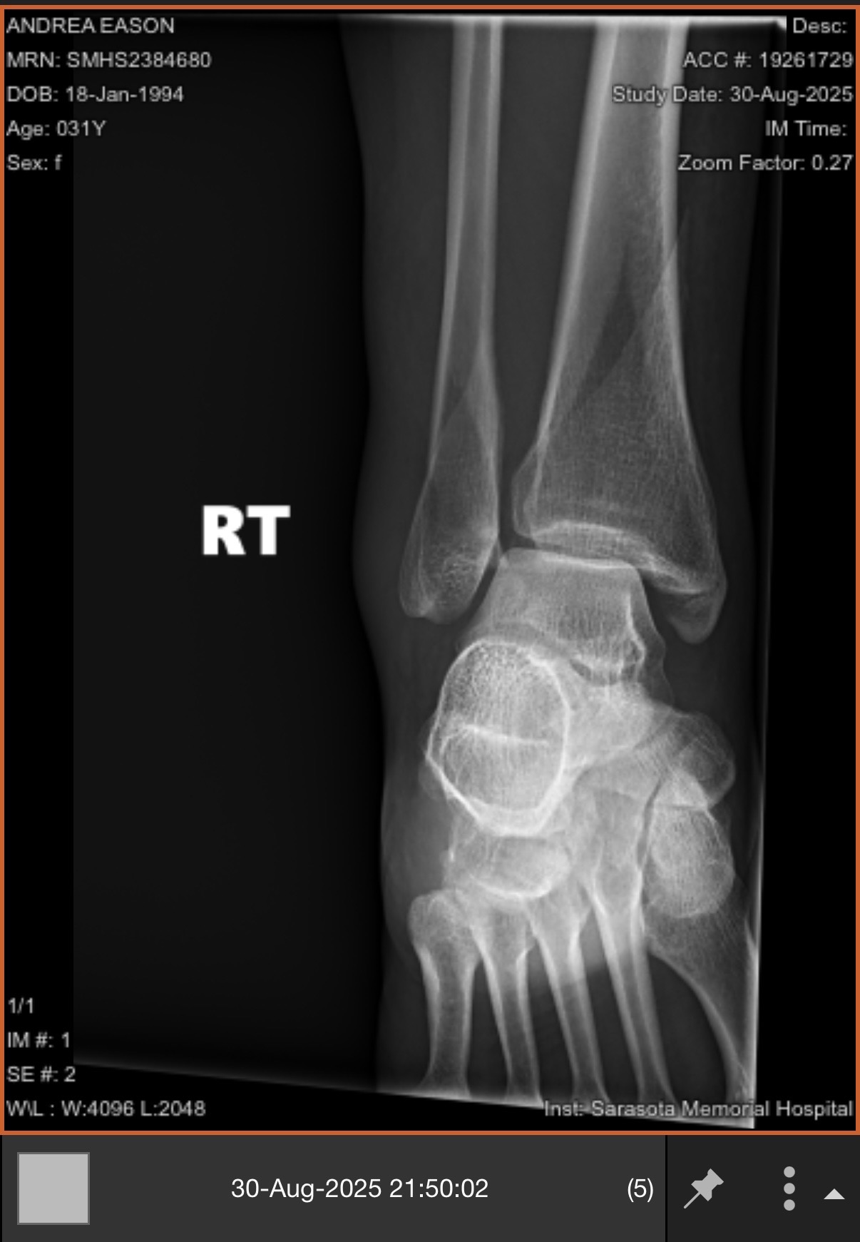 To help Dreya get back on her feet! campaign photo, 6 of 7