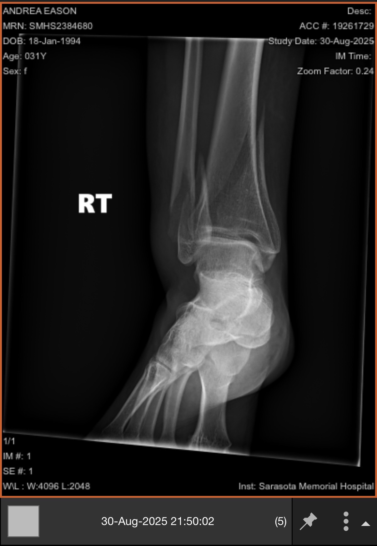 To help Dreya get back on her feet! campaign photo, 2 of 7