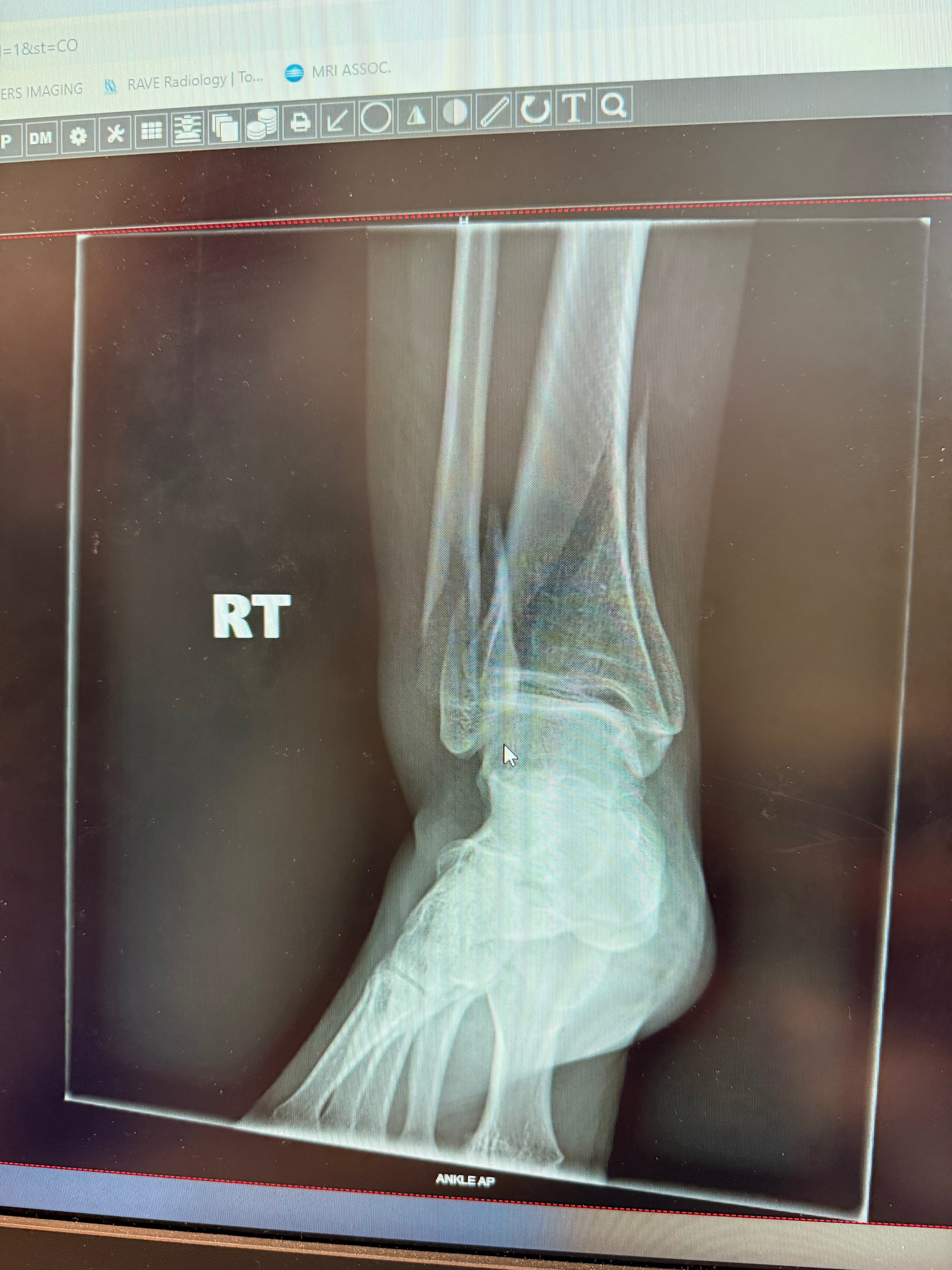To help Dreya get back on her feet! campaign photo, 5 of 7
