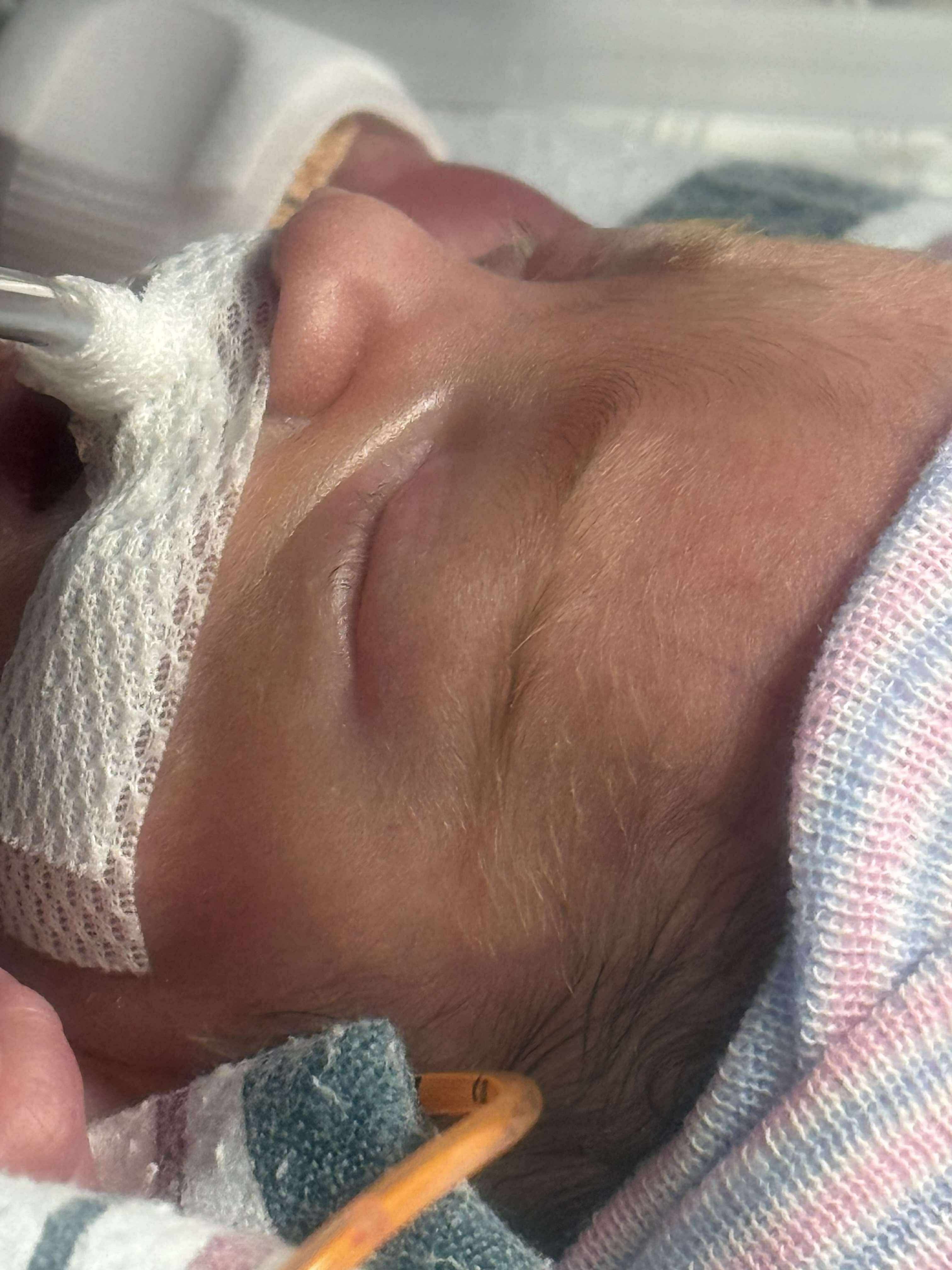 Preemie Baby Santiago’s (Santi) & his NICU Journey campaign photo, 5 of 6
