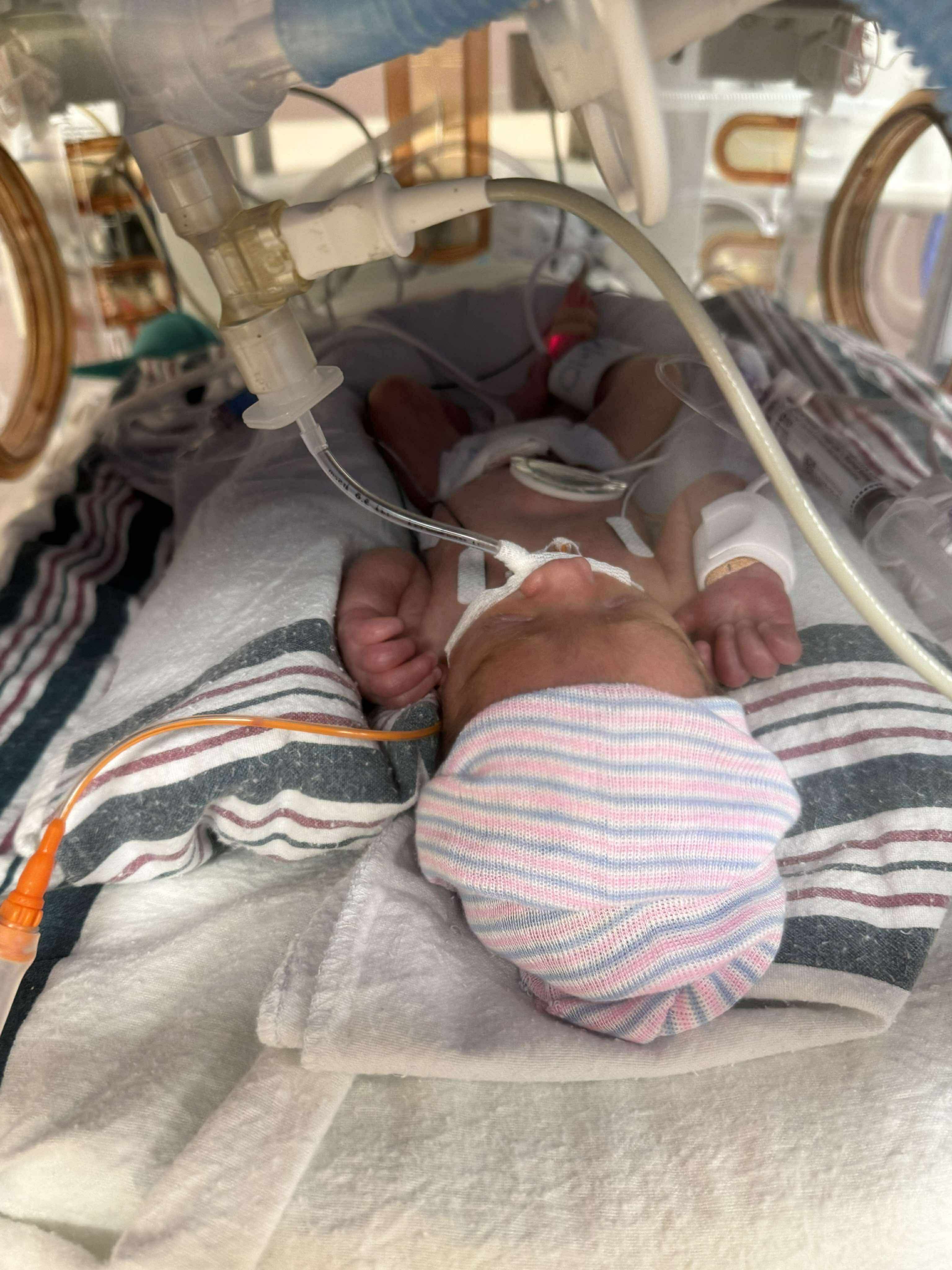 Preemie Baby Santiago’s (Santi) & his NICU Journey campaign photo, 2 of 6