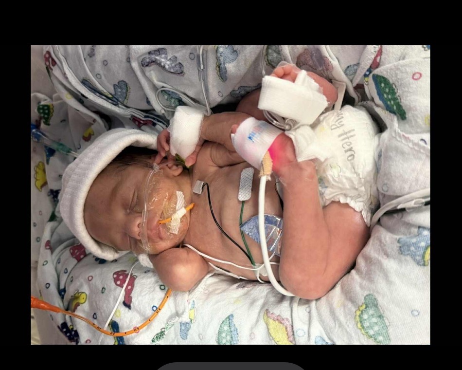 Preemie Baby Santiago’s (Santi) & his NICU Journey campaign photo, 4 of 6