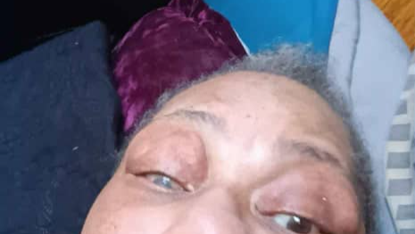 Support Constance's Urgent Eye Surgery photo