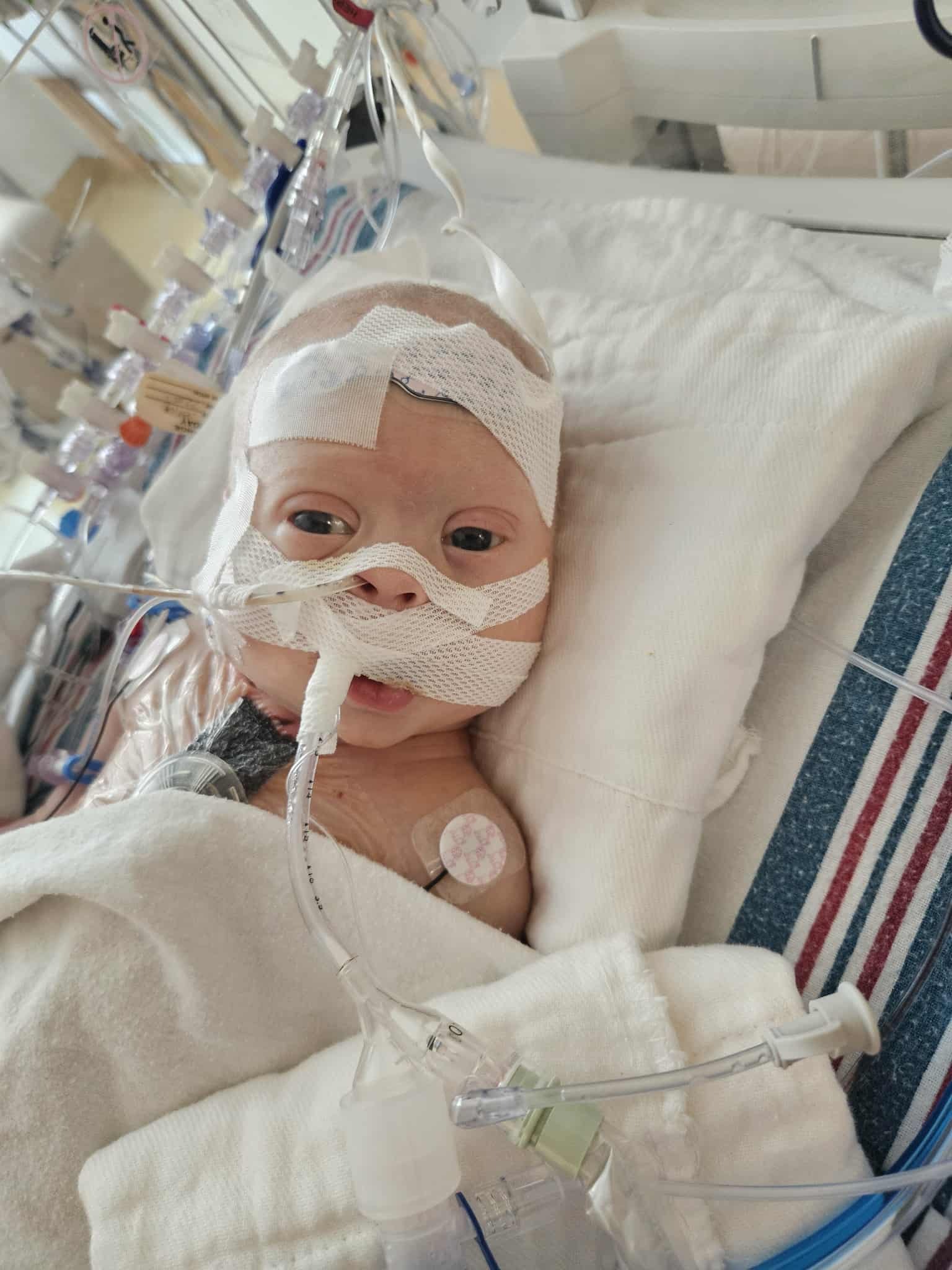Support Baby Raymond's Fight for Life campaign photo, 5 of 8