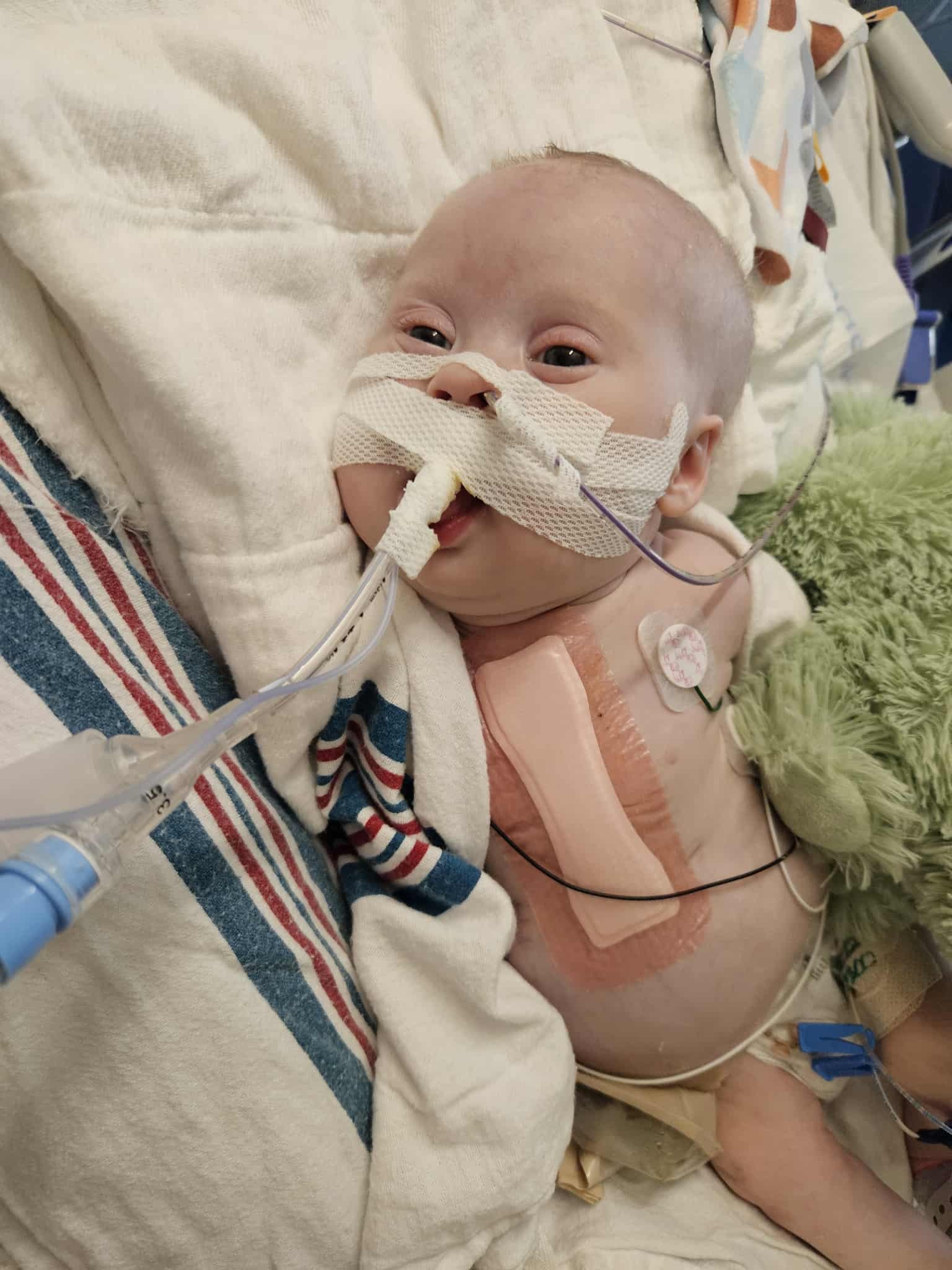 Support Baby Raymond's Fight for Life campaign photo, 6 of 8