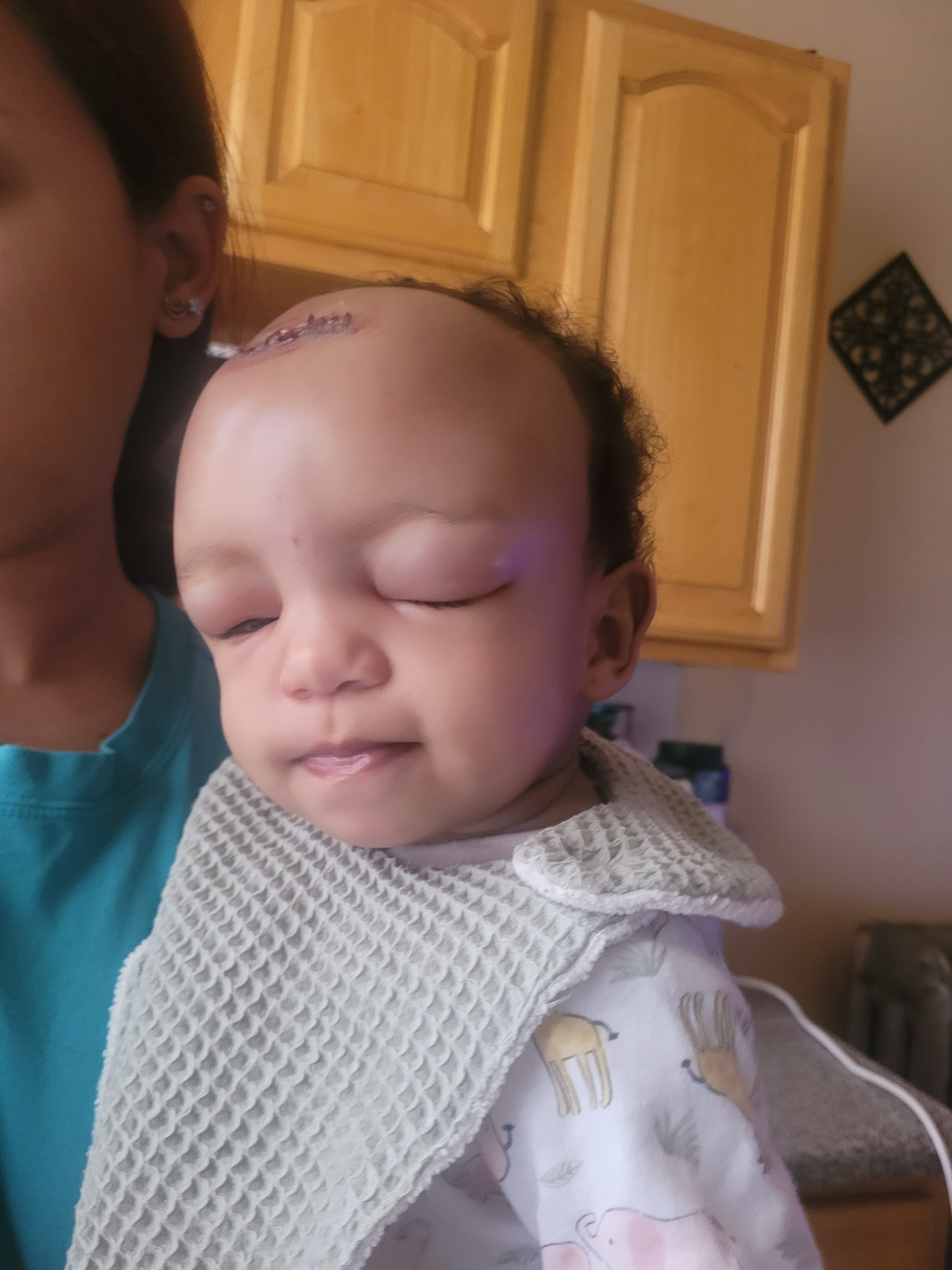 Support Ellie: Help with Medical Expenses campaign photo, 4 of 8