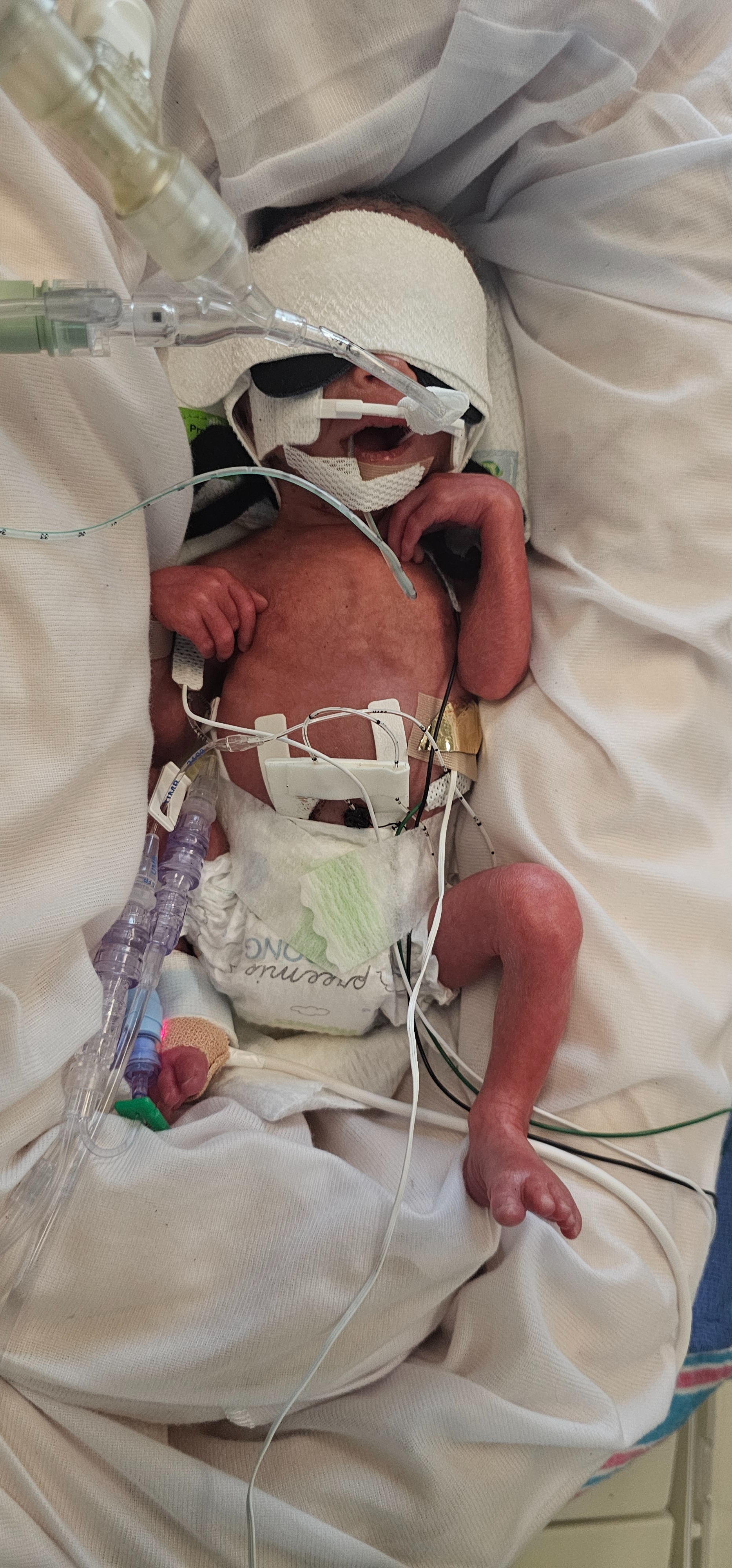 Help April Fight Leukemia & Support Baby Nico campaign photo, 6 of 8