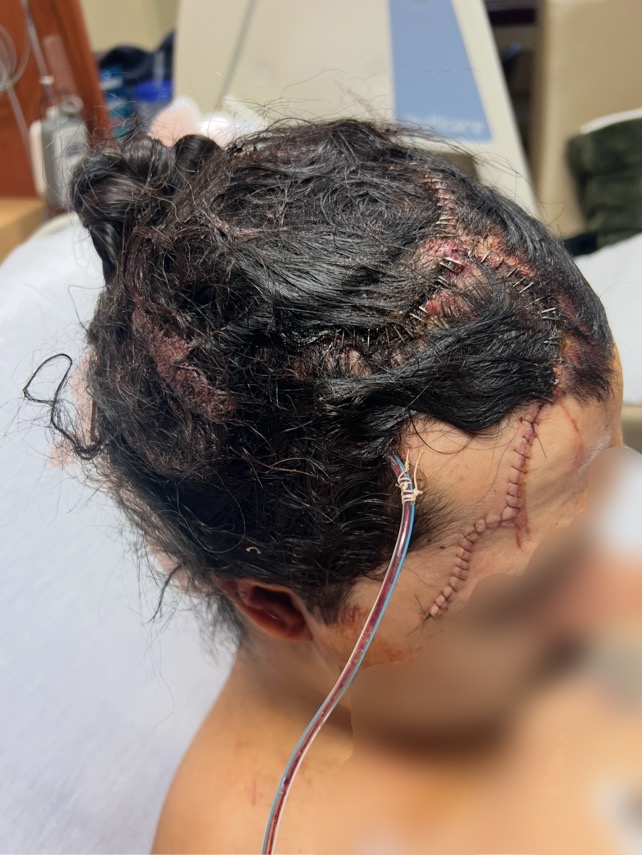 Every Bit Helps: Paully’s Healing Journey campaign photo, 5 of 8