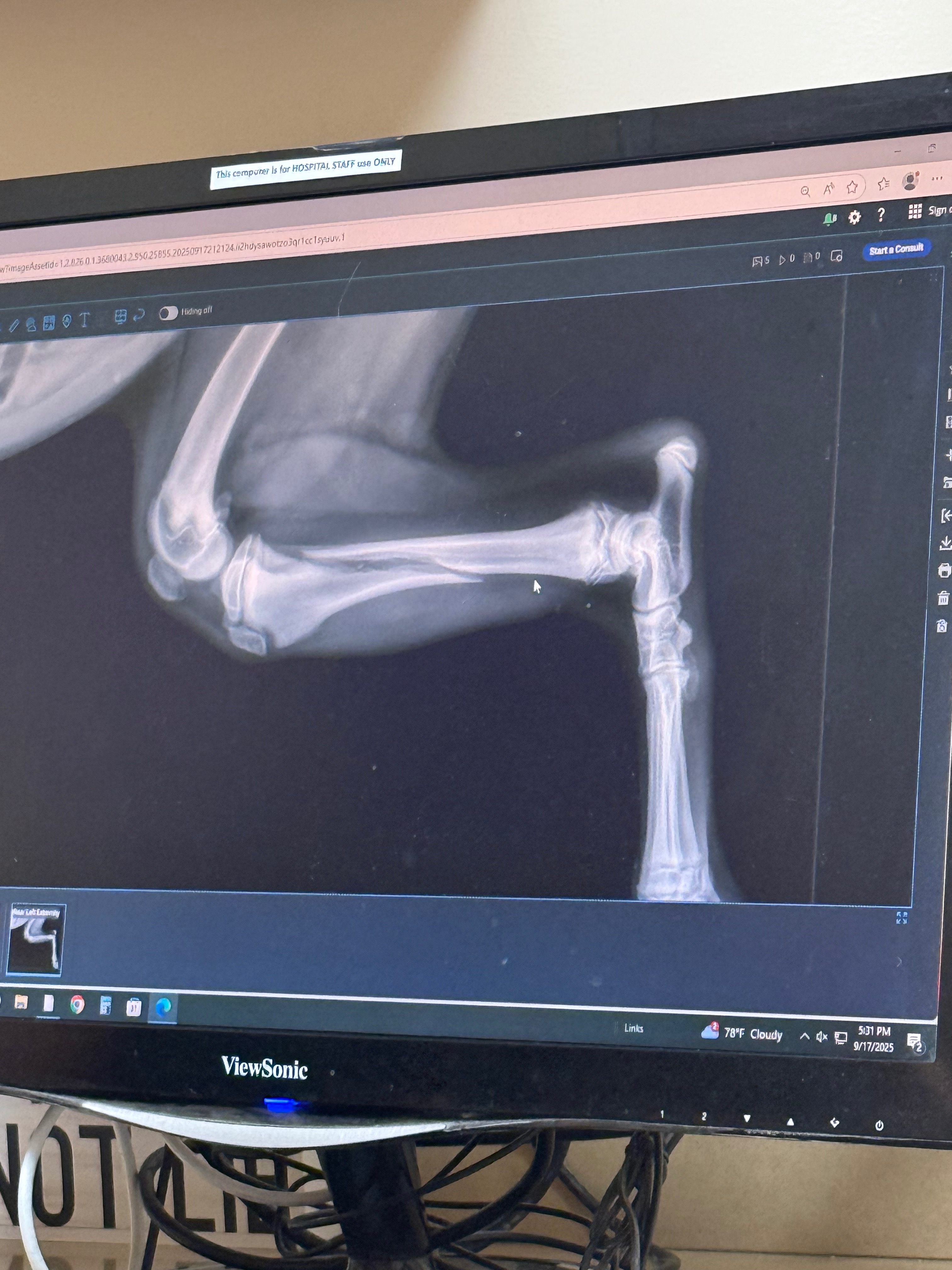 Help Dior Walk Again: Leg Surgery Fund campaign photo, 5 of 7