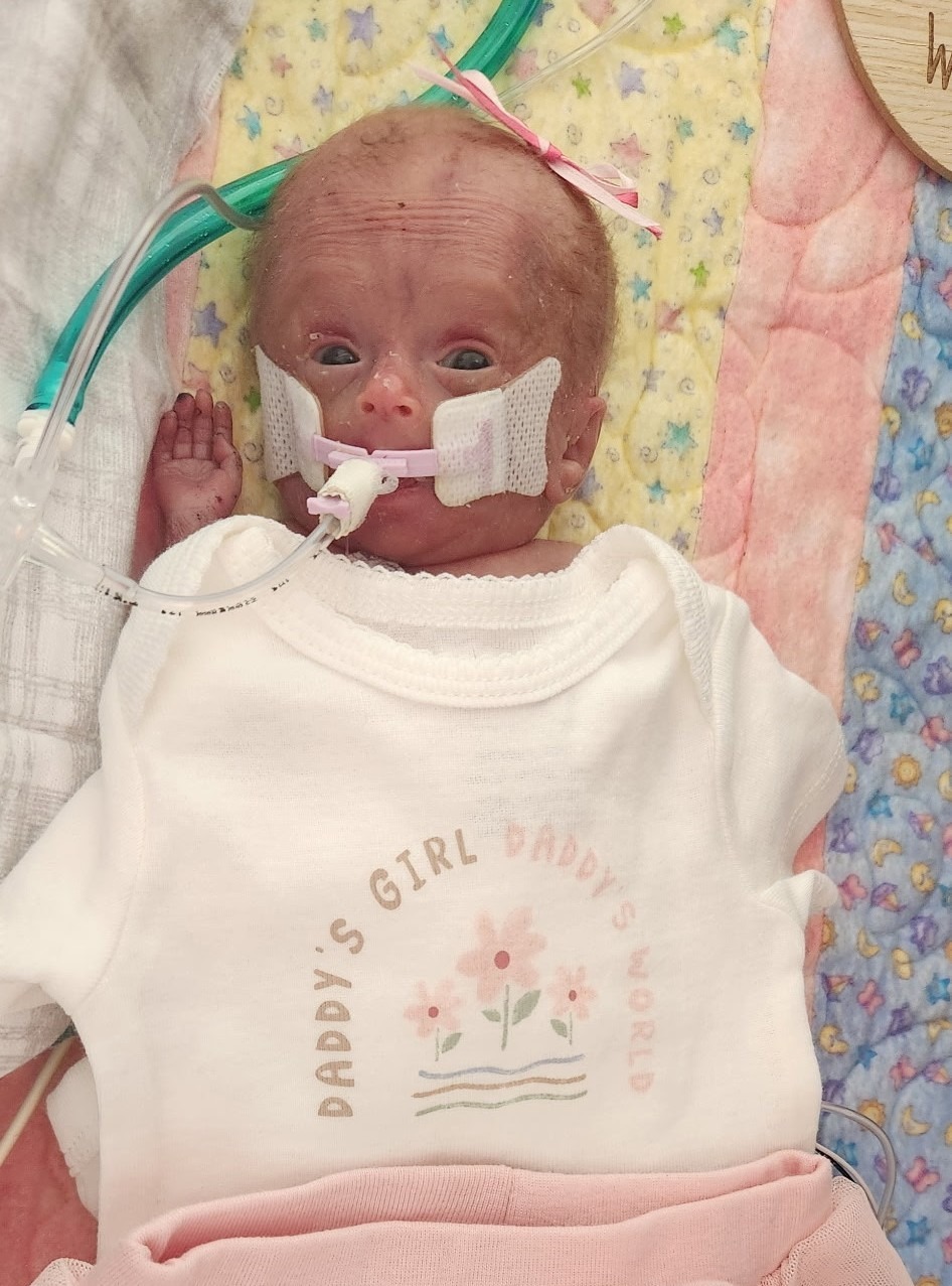 Remembering Clare and Helping Allison – Jill & Zach's Twins campaign photo, 2 of 5