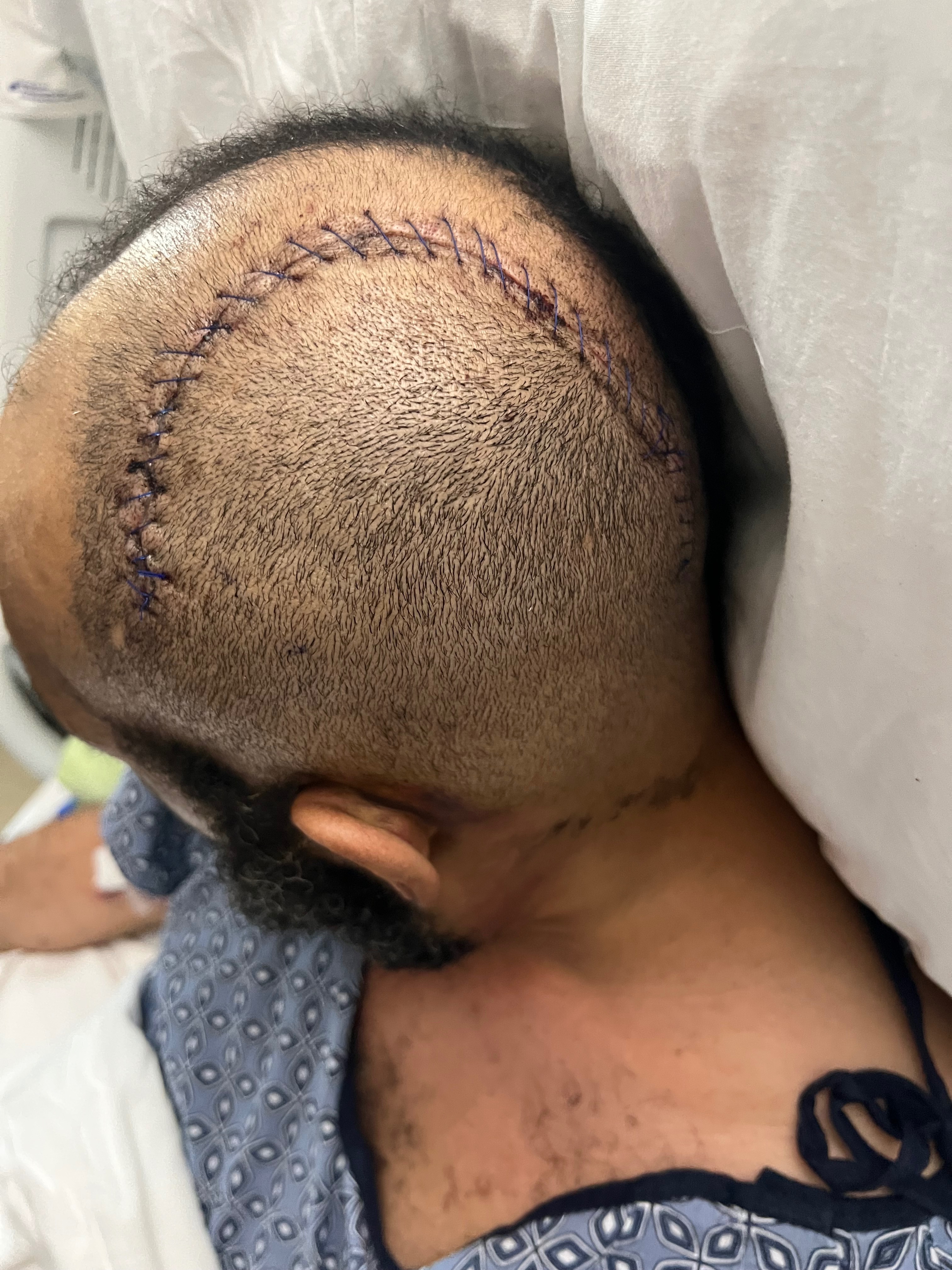Support Carl’s Family after battling Stage4 Cancer campaign photo, 2 of 7